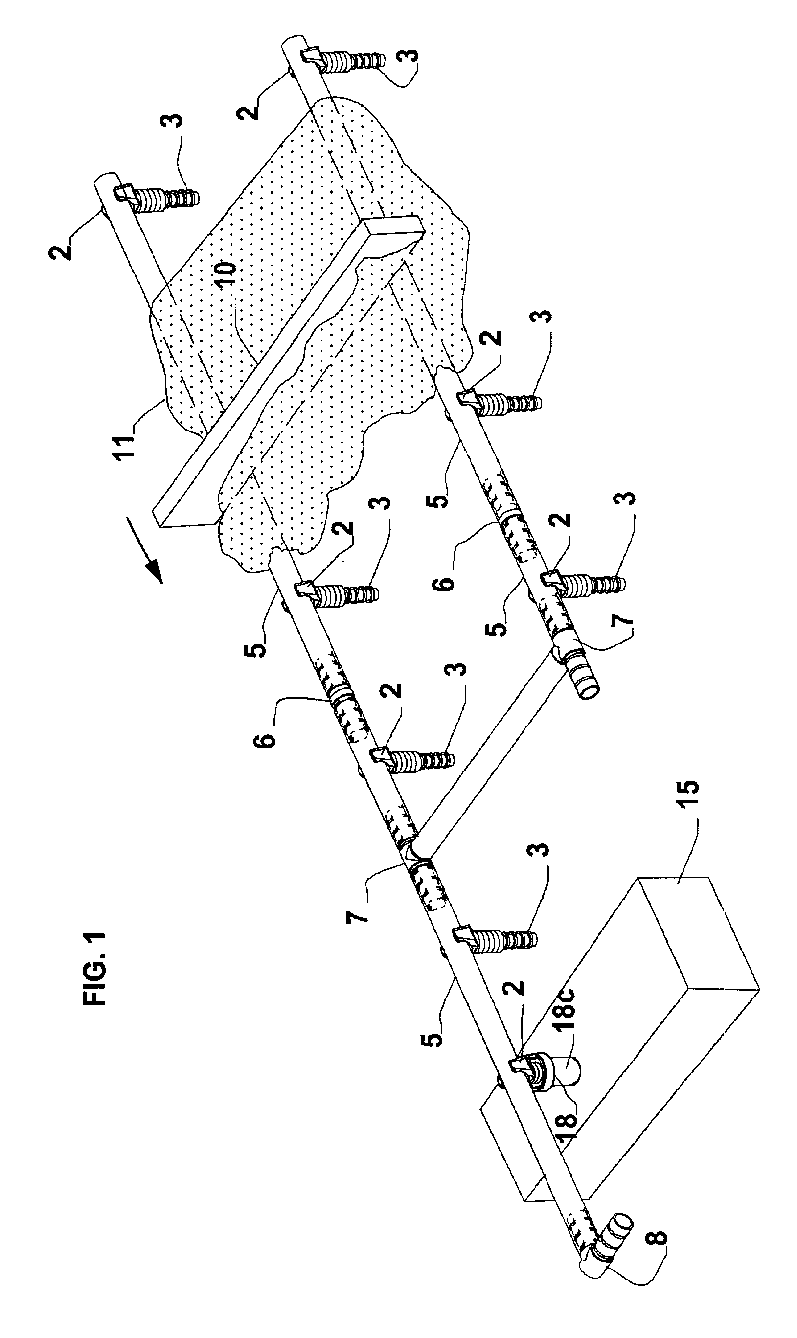 Screed ski and support system and method