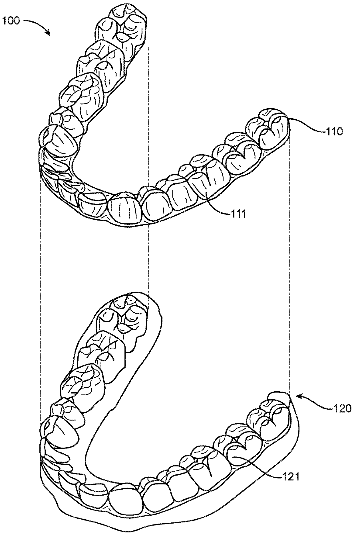 Systems, methods, and apparatus for correcting malocclusions of teeth