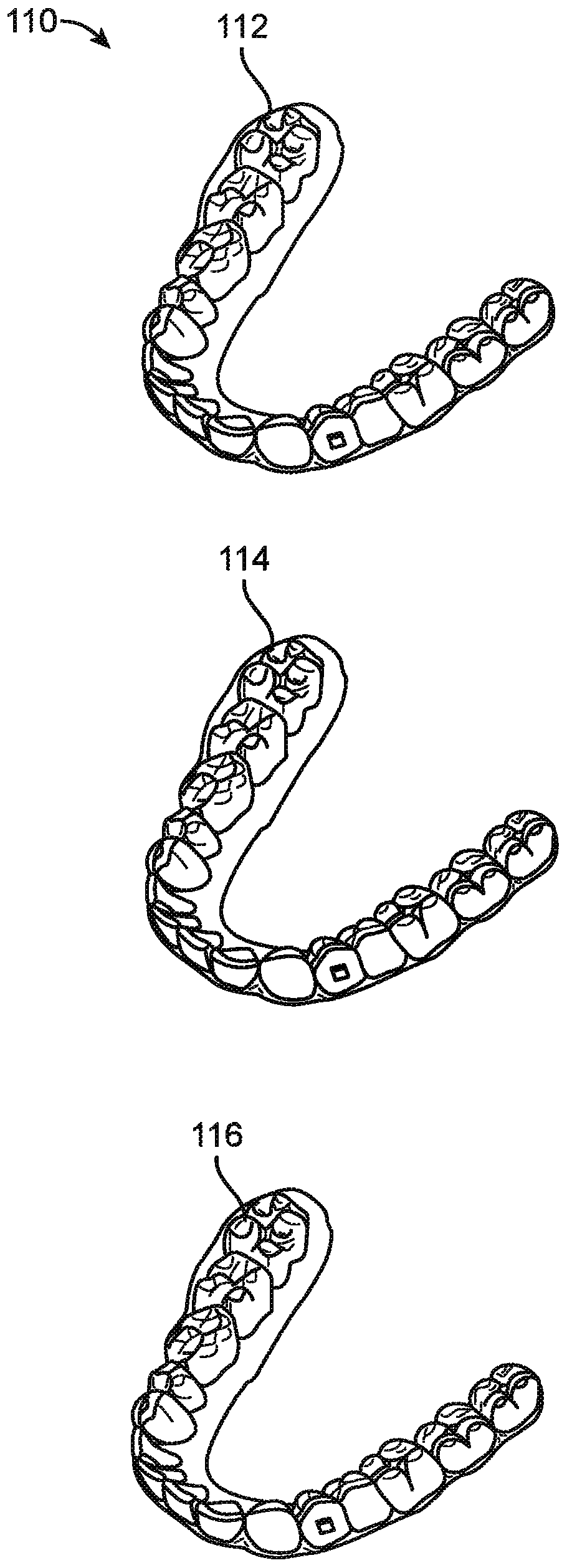 Systems, methods, and apparatus for correcting malocclusions of teeth