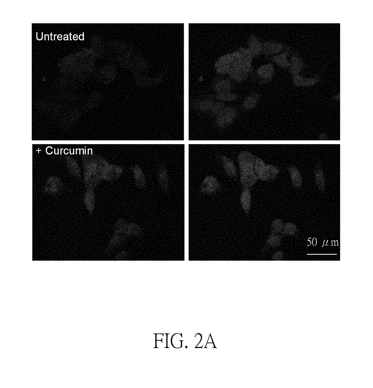 Method for Treating Abnormal B-Amyloid Aggregation Mediated Diseases