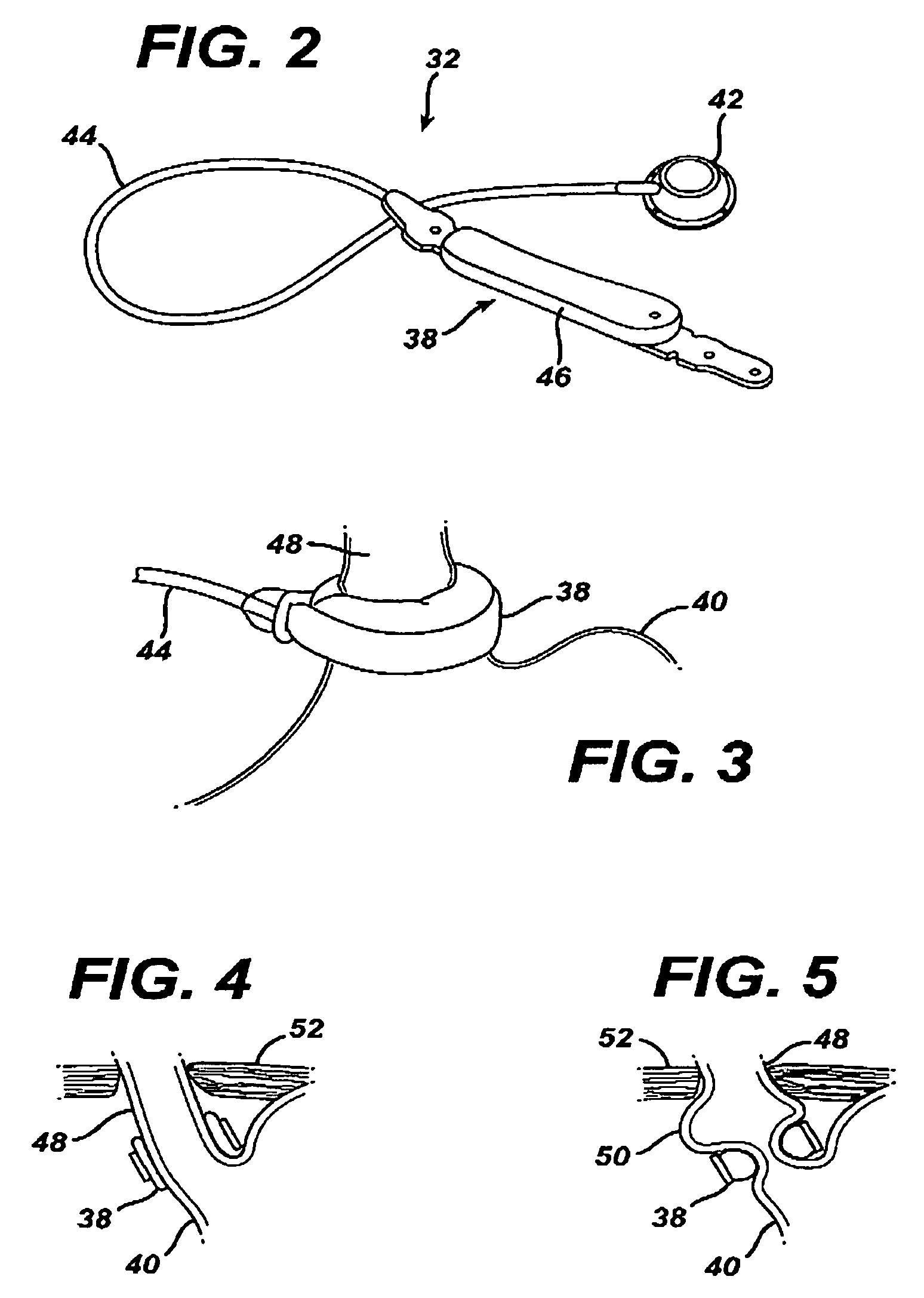 Device for non-invasive measurement of fluid pressure in an adjustable restriction device