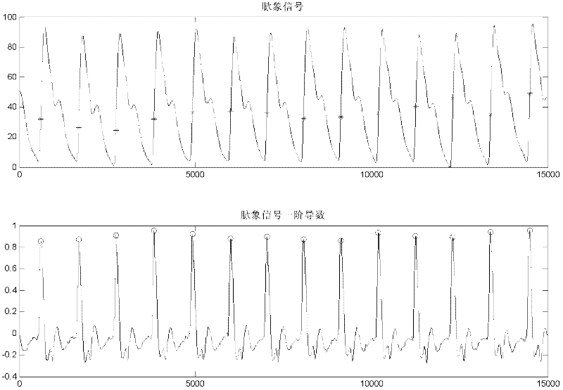 A Time Domain Feature Extraction Method of Pulse Signal