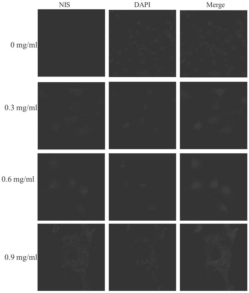 Application of total glucosides of paeony in the preparation of drugs for treating thyroid cancer and improving the synergistic effect of tumor radiotherapy