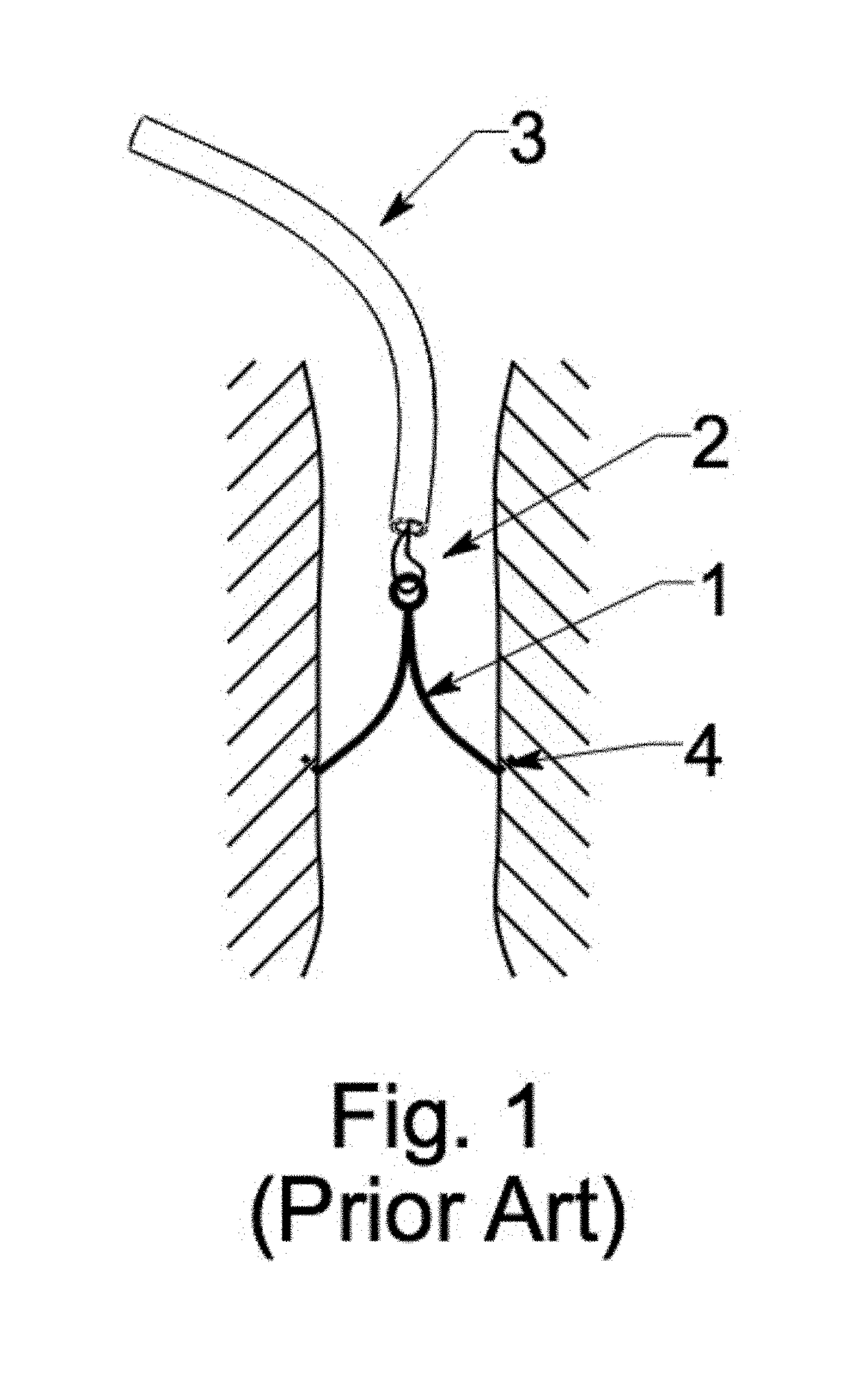 Multi lumen IVC filter retrieval device