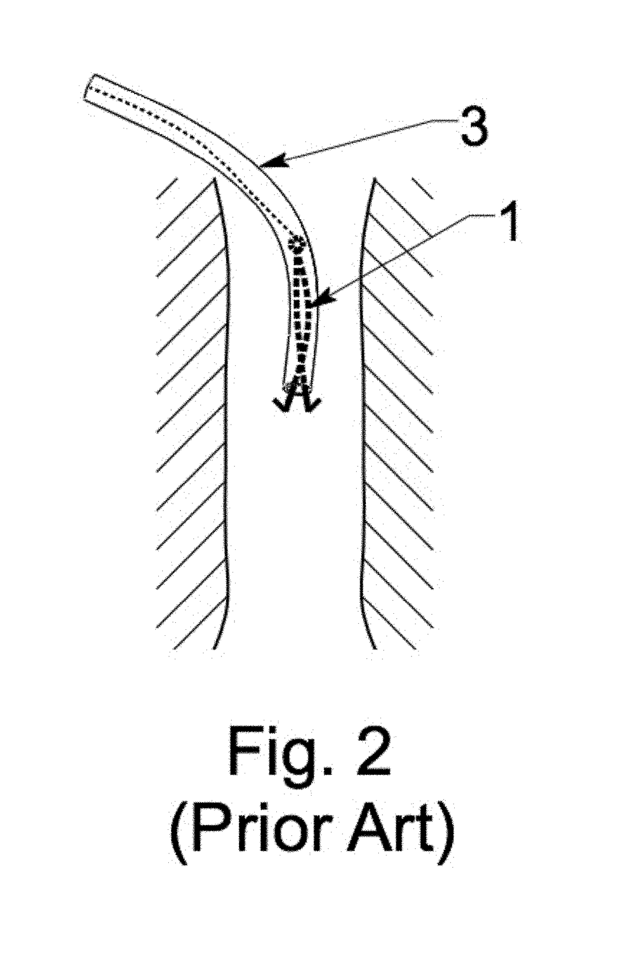 Multi lumen IVC filter retrieval device