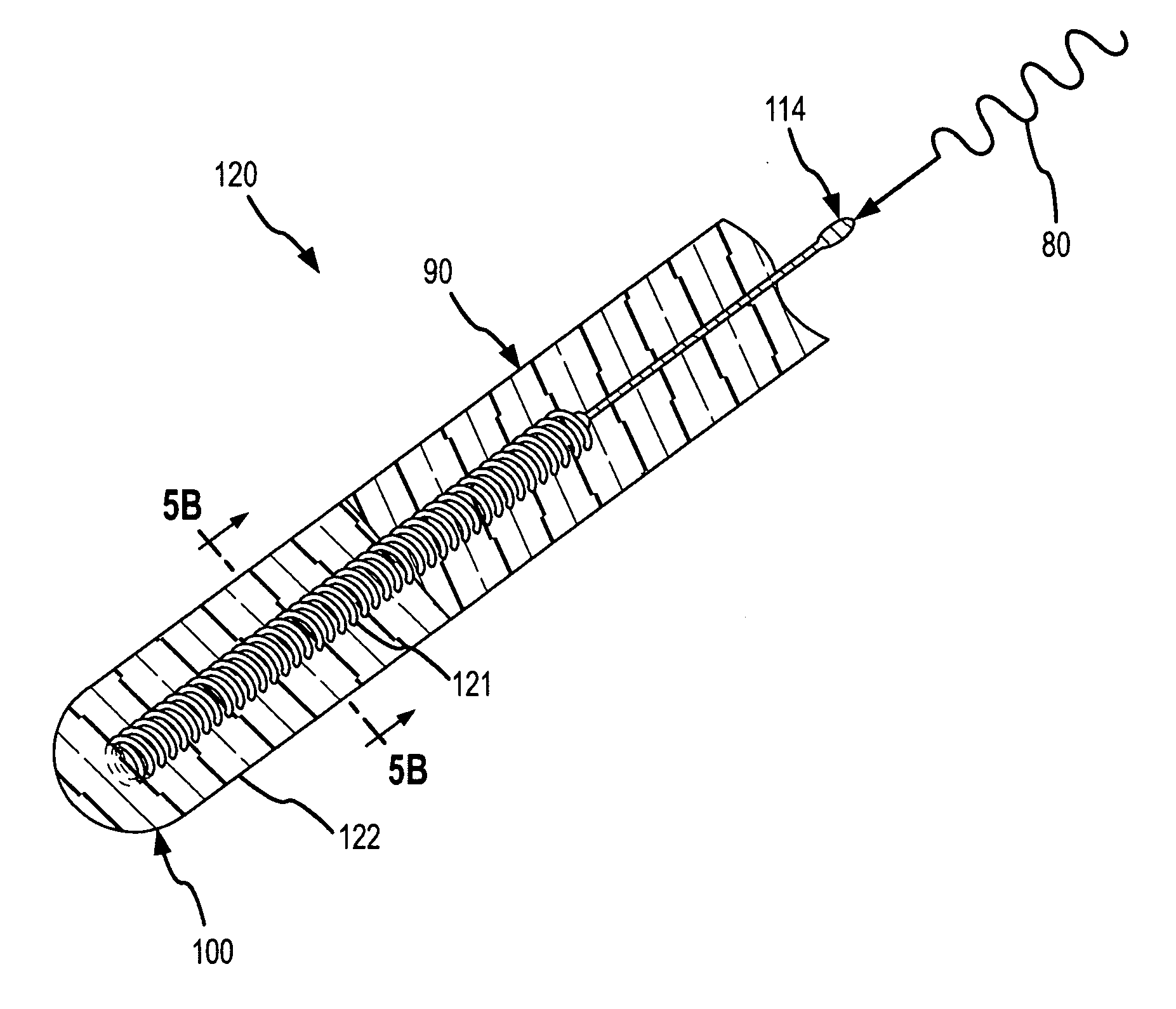 Contact-sensitive pressure-sensitive conductive composite electrode and method for ablation
