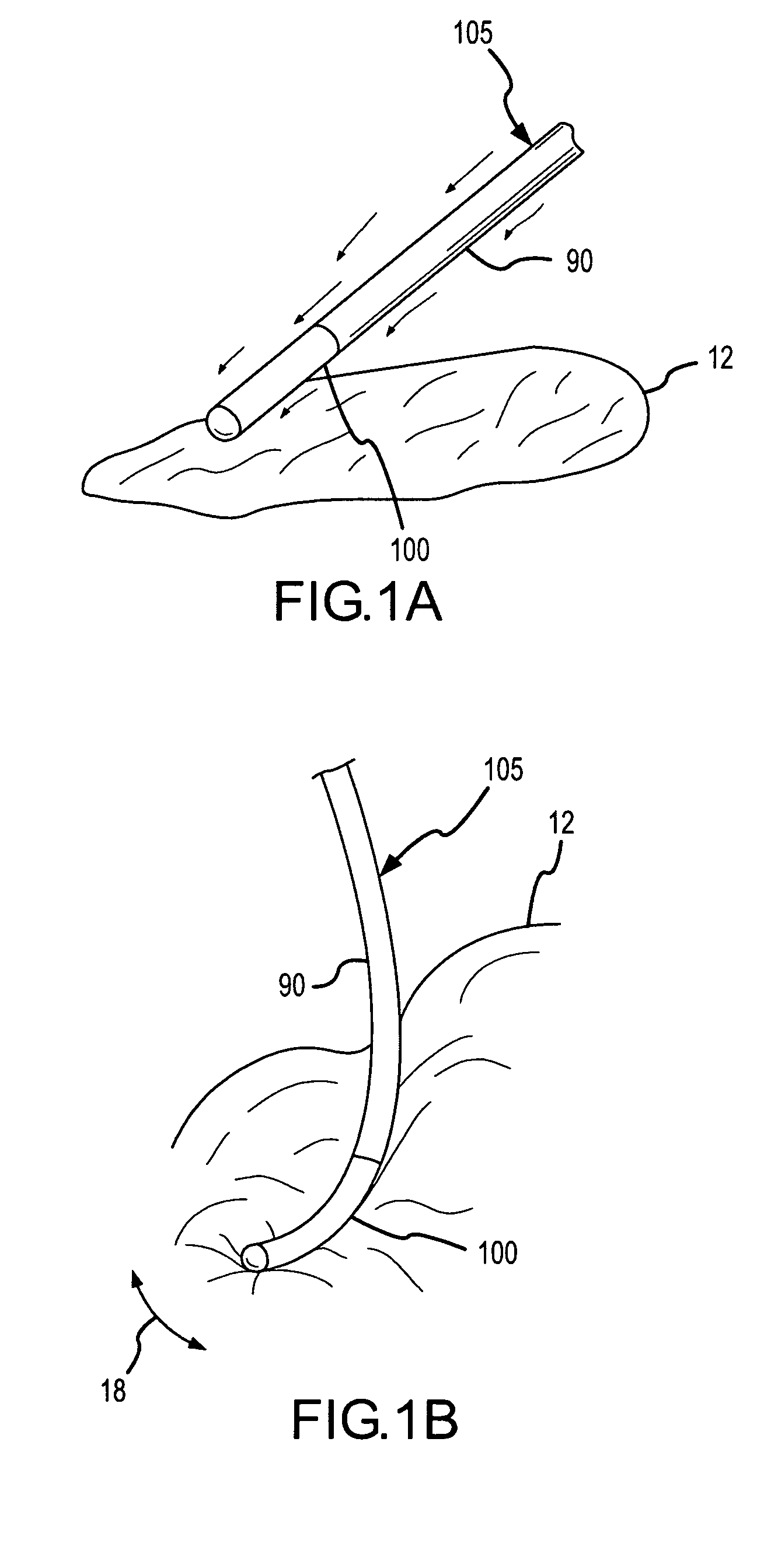Contact-sensitive pressure-sensitive conductive composite electrode and method for ablation