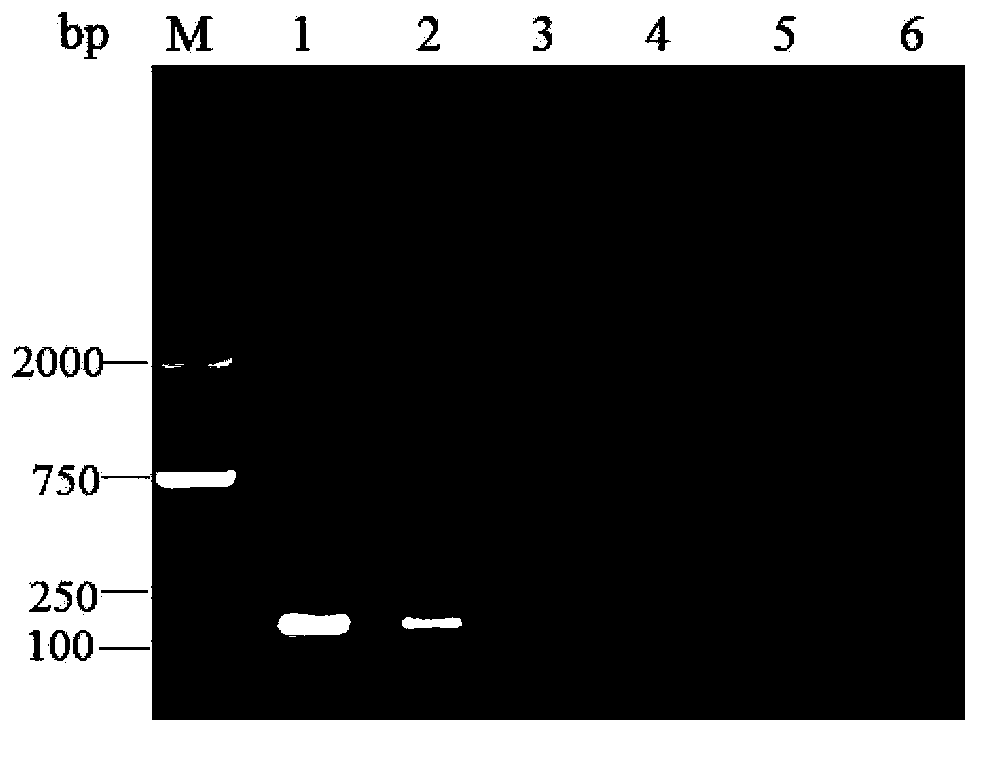 Hybrid snakehead rhabdovirus fluorescent quantitative PCR (polymerase chain reaction) detection kit and detection method thereof