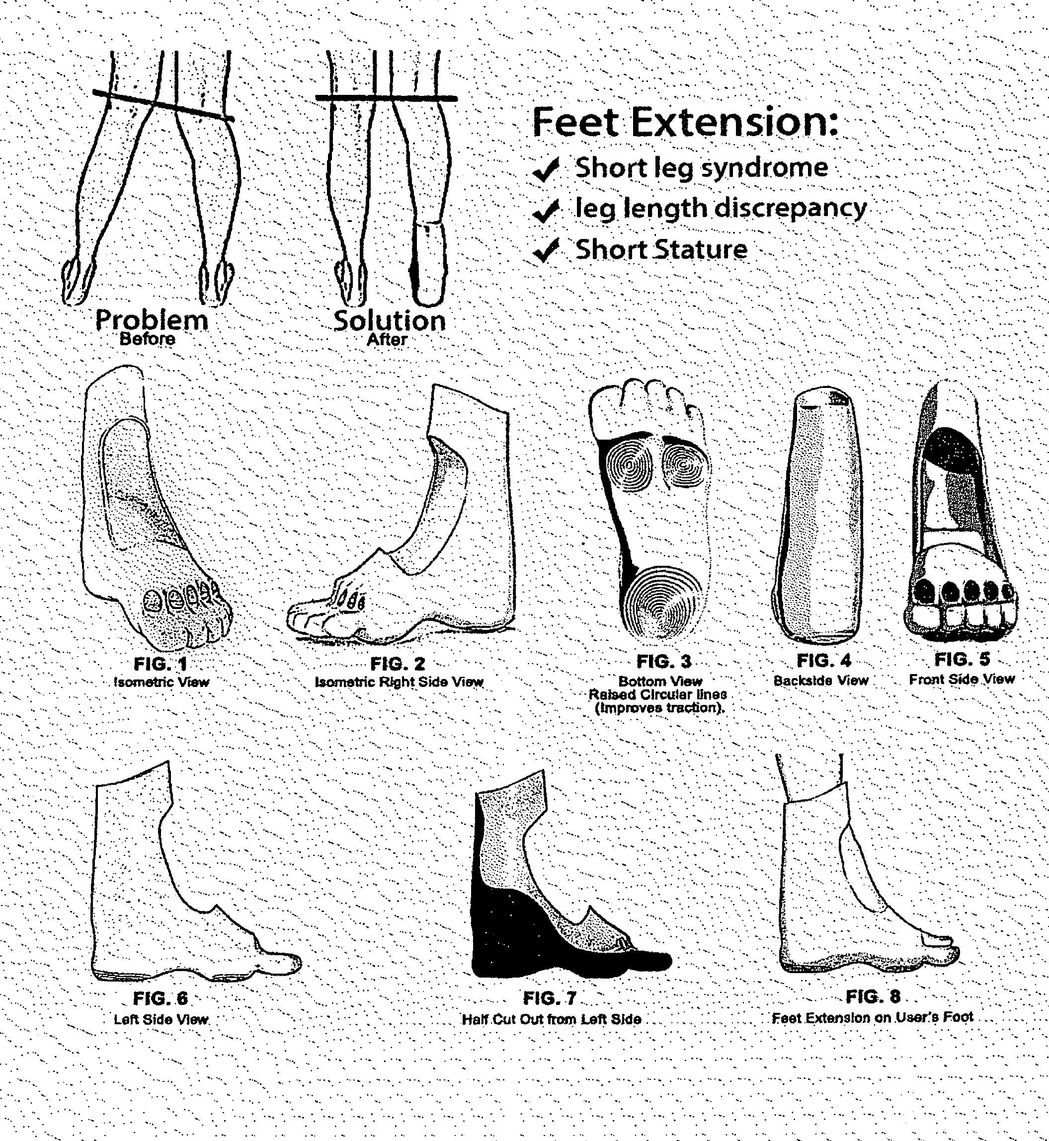 Feet Extensions