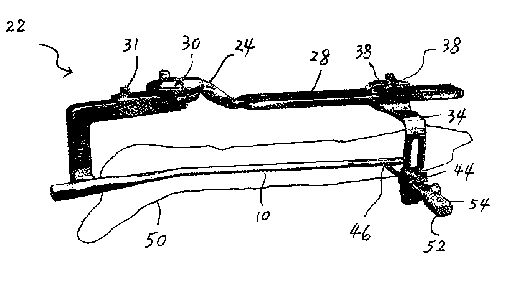 Sensing Device for Medical Procedure