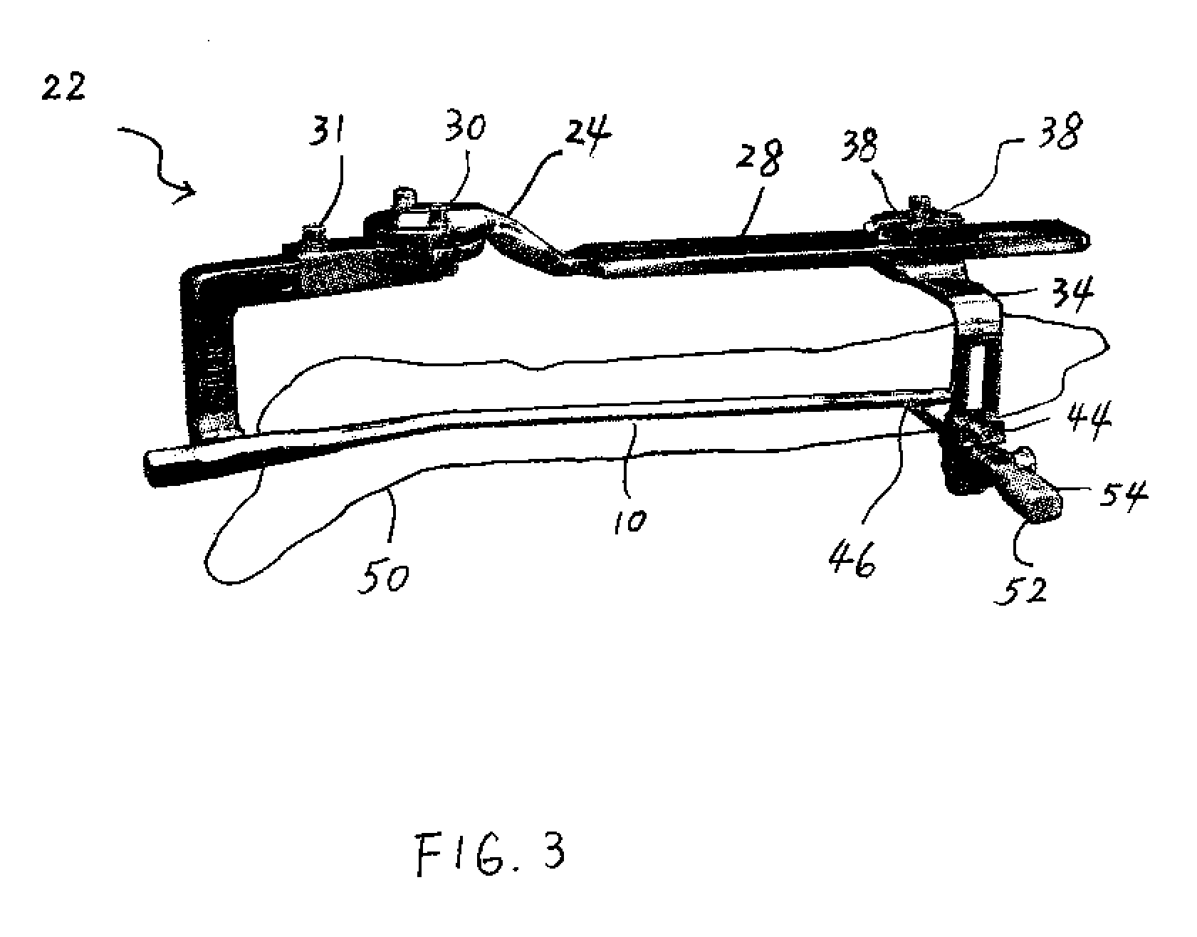 Sensing Device for Medical Procedure