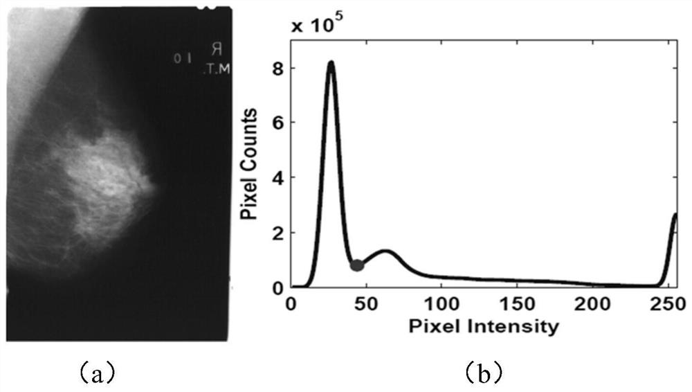 Mammary gland X-ray image lesion detection method and device based on normal model learning