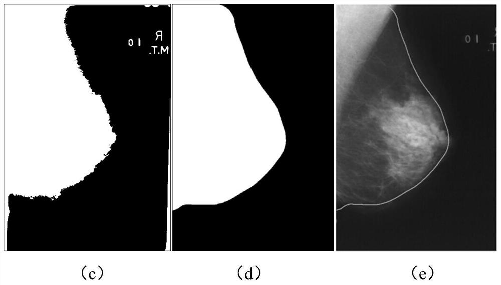 Mammary gland X-ray image lesion detection method and device based on normal model learning