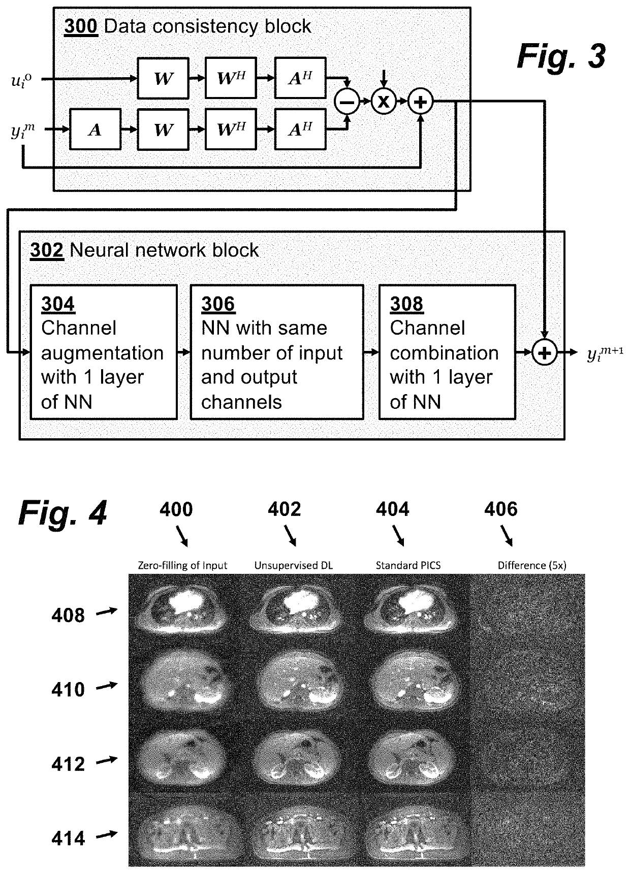 Method for performing magnetic resonance imaging reconstruction with unsupervised deep learning