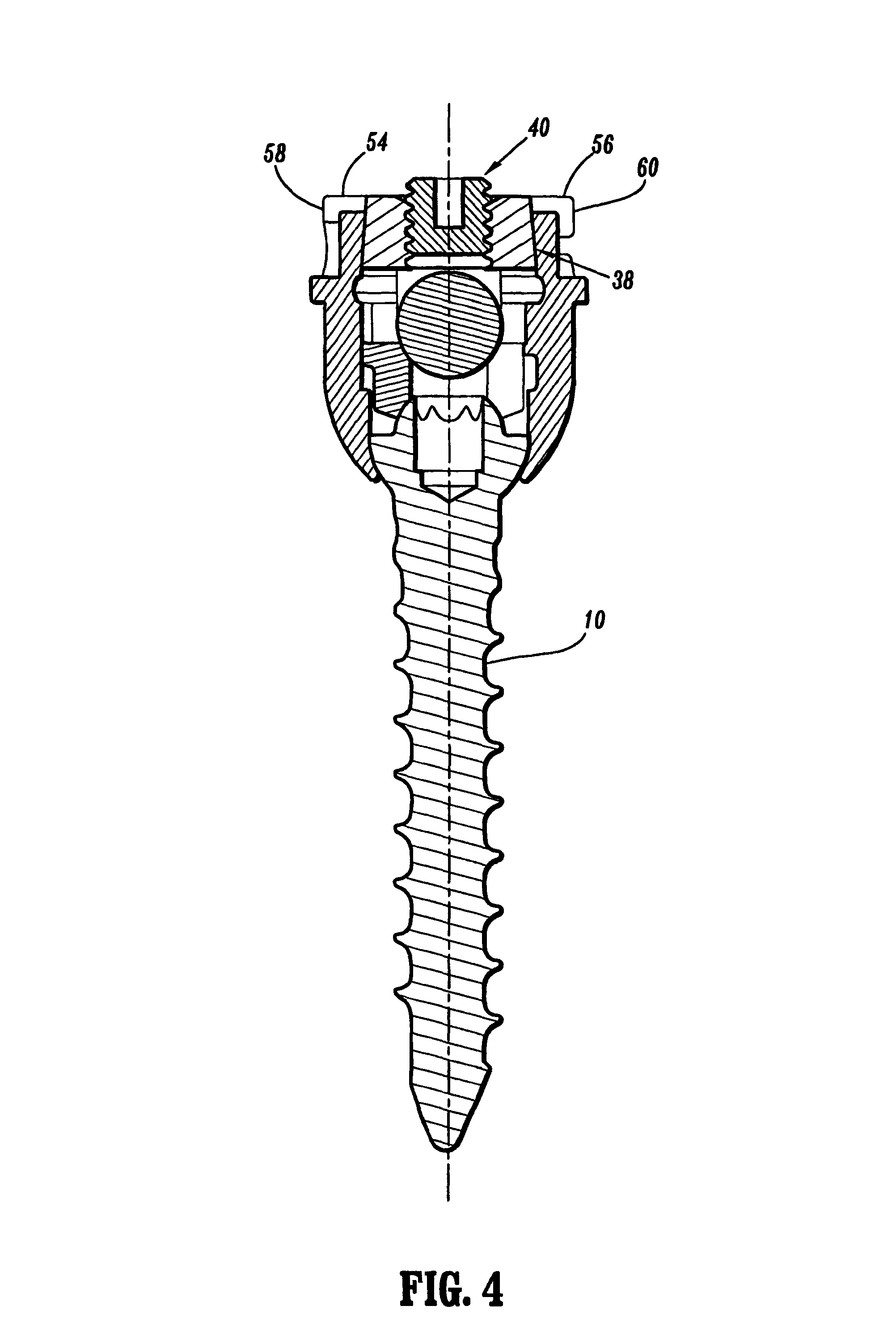 Orthopedic rod system