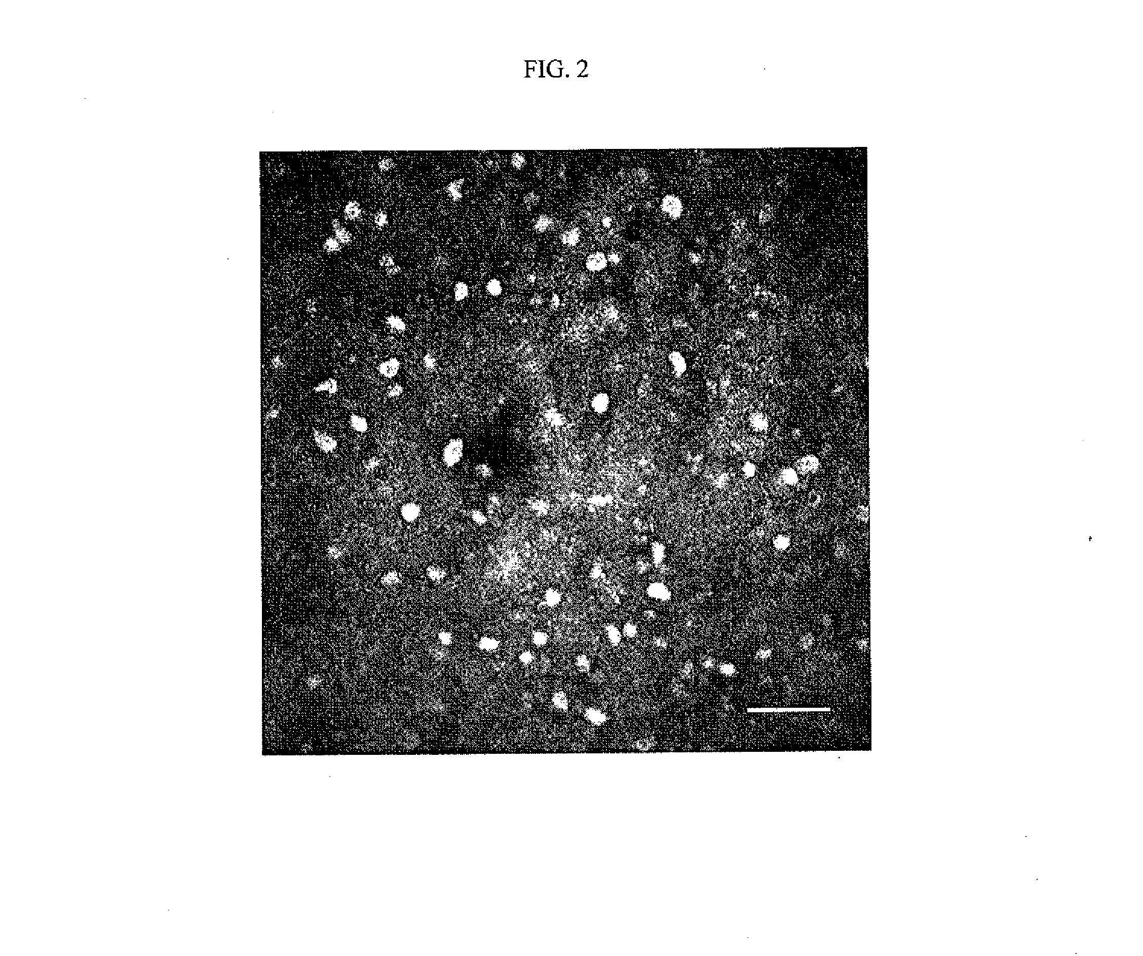 Model system of acanthamoeba keratitis syndrome and method for selecting a treatment thereof