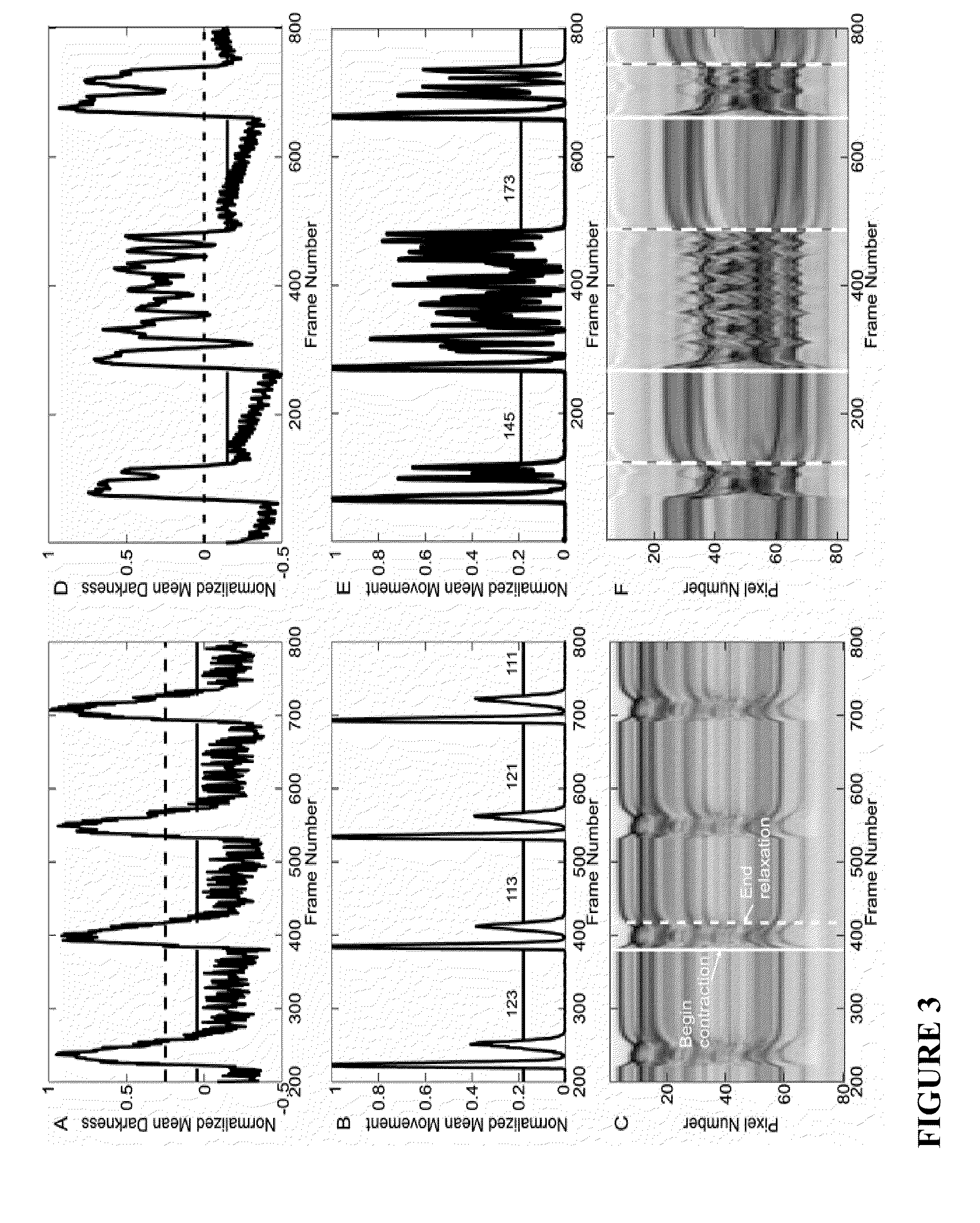 Compositions and methods for screening cardioactive drugs