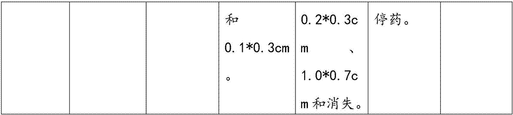 Traditional Chinese medicine gel for treating hemorrhoids and preparation method thereof