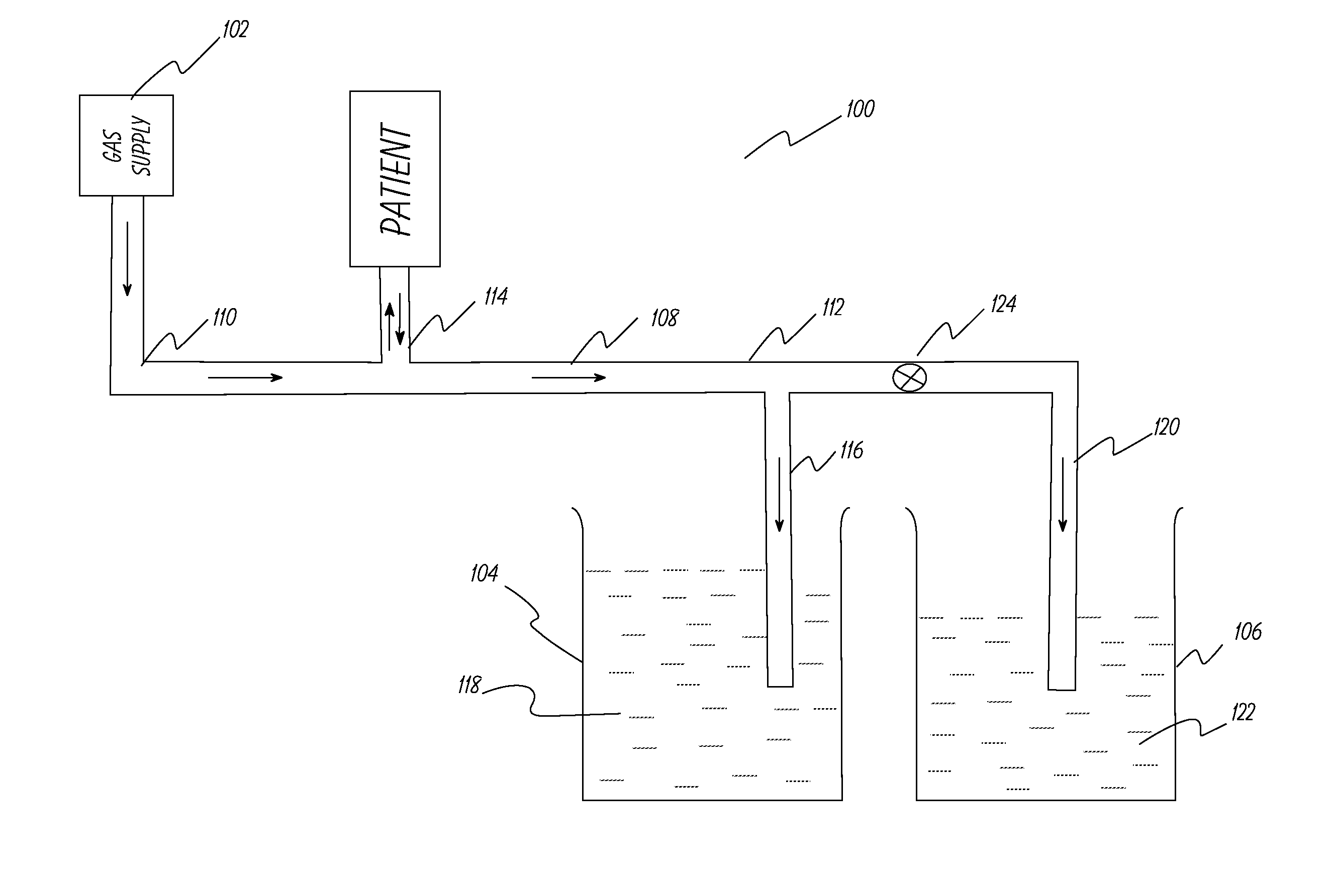 Apparatus and method to provide breathing support