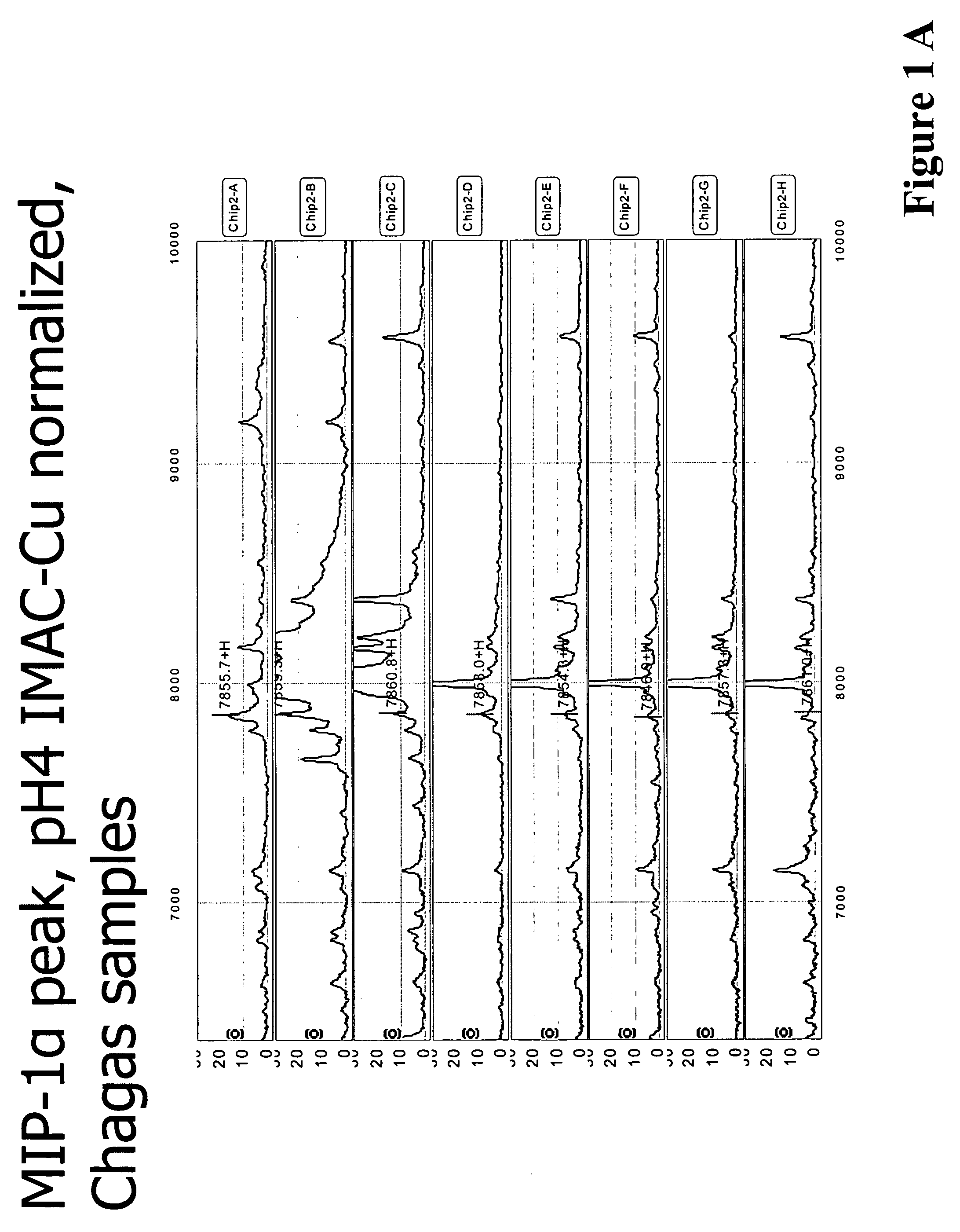 Serum biomarkers for Chagas disease