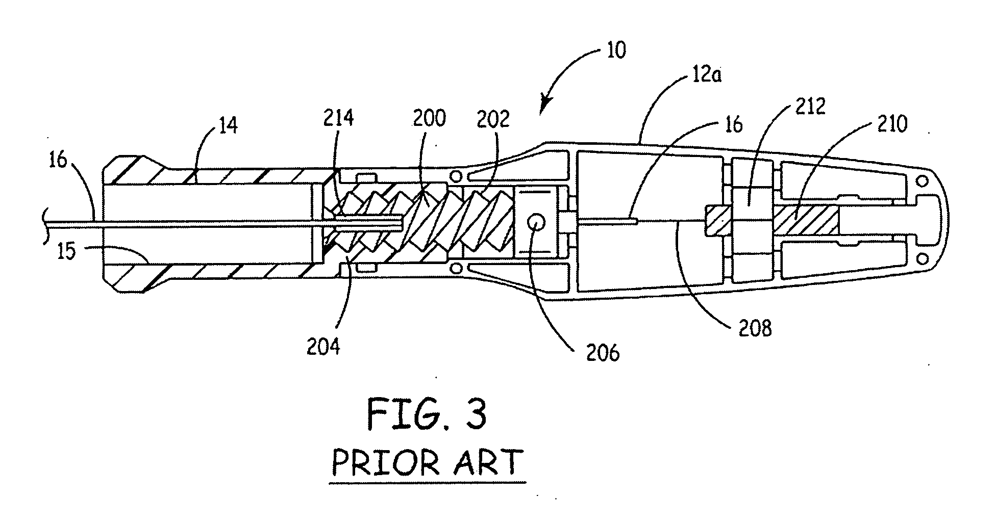 Method and apparatus for deflecting a screw-in lead