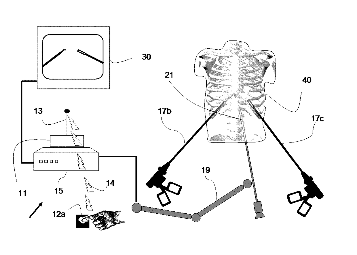 Device and method for assisting laparoscopic surgery - rule based approach