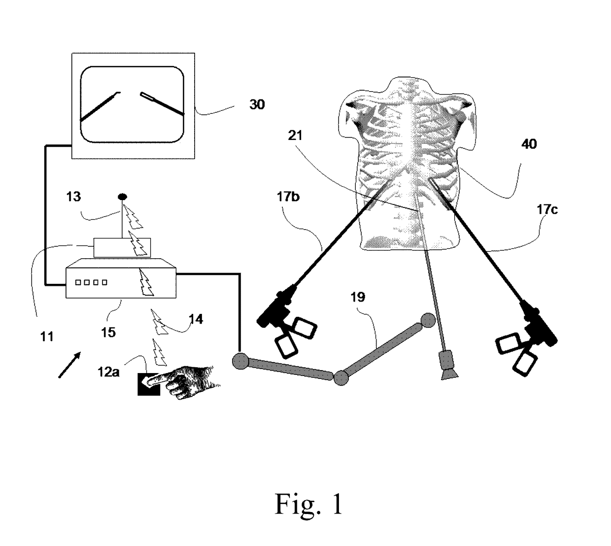 Device and method for assisting laparoscopic surgery - rule based approach