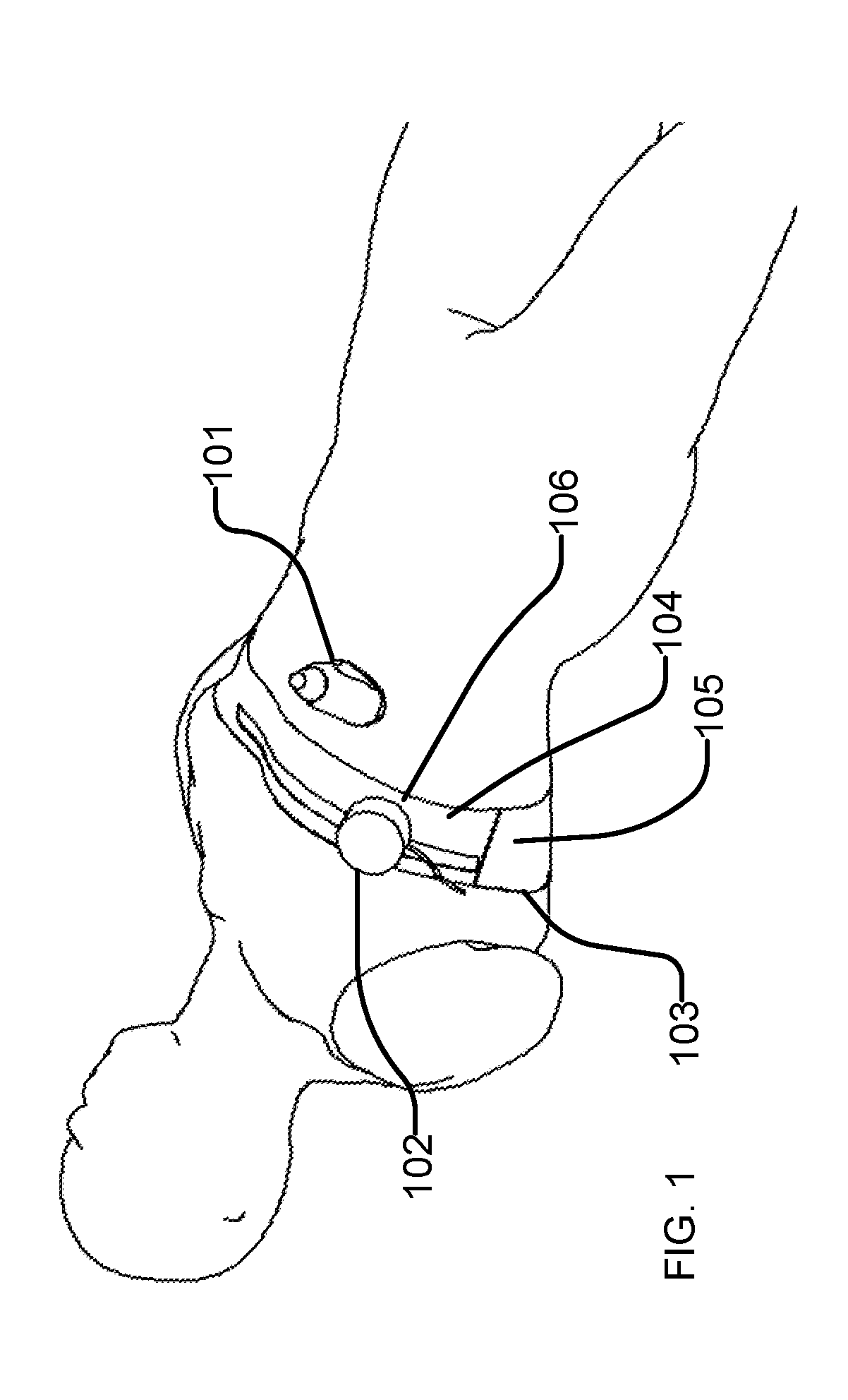 Ultrasound shear wave vibro-elastography of the abdomen