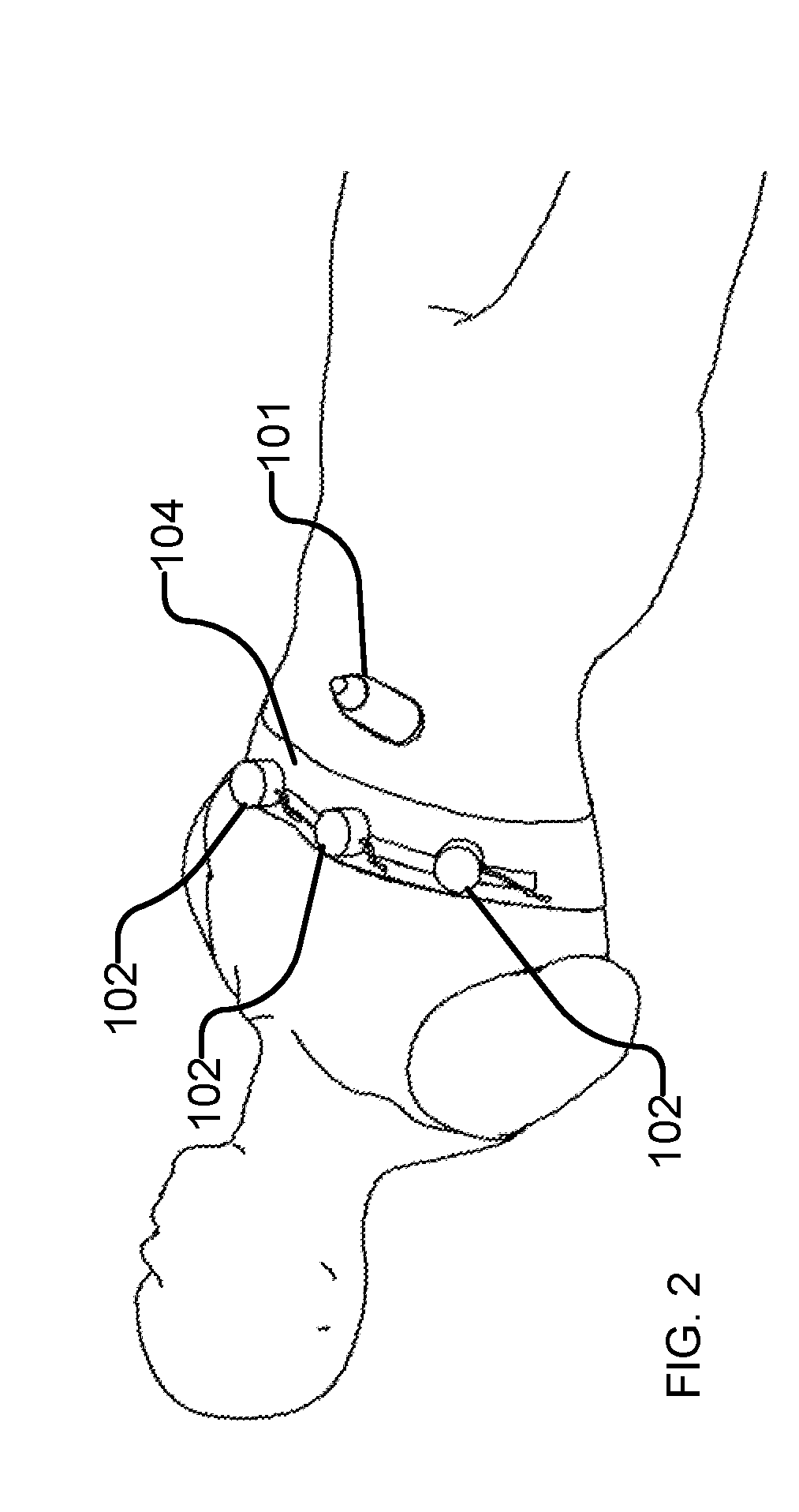 Ultrasound shear wave vibro-elastography of the abdomen