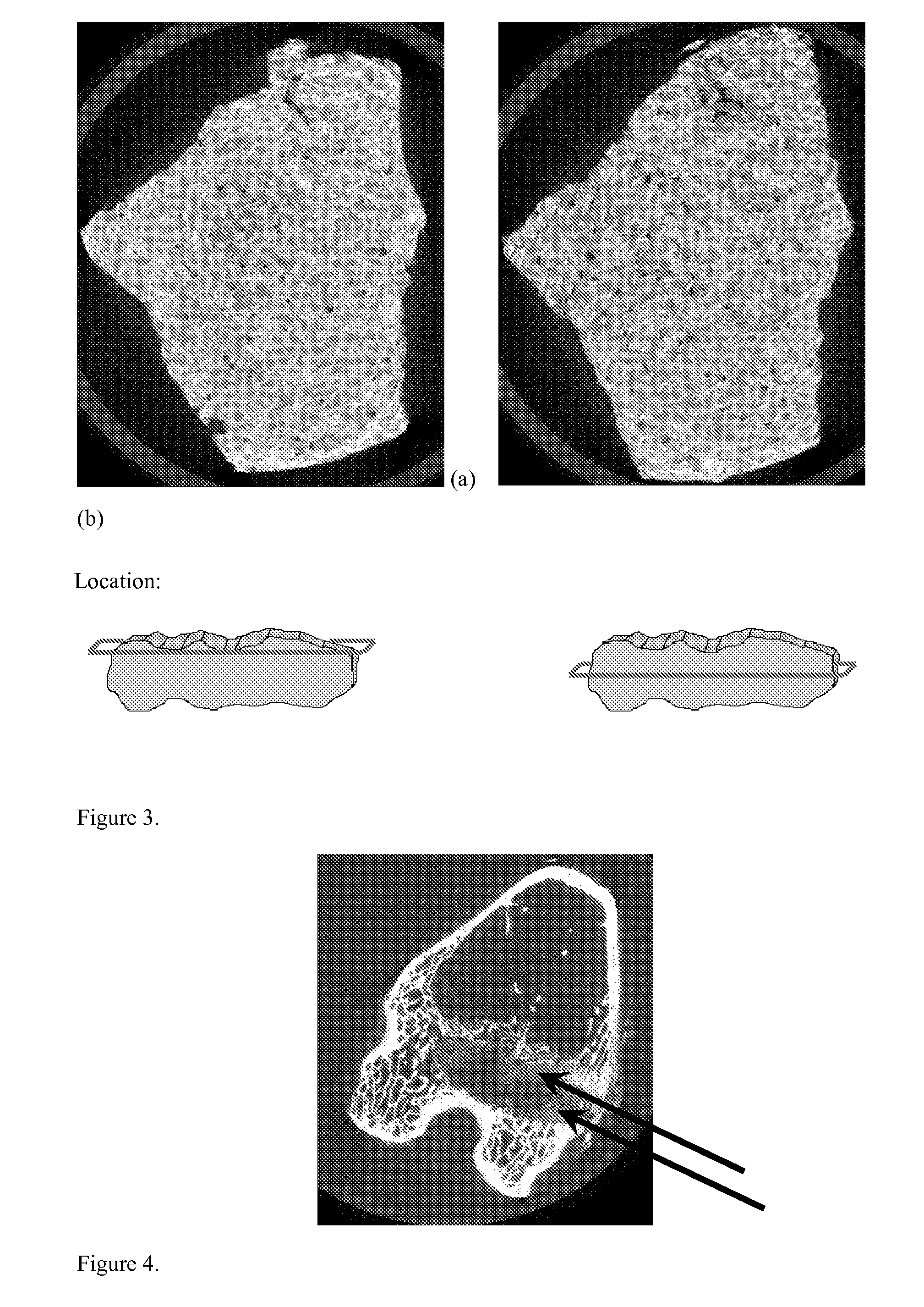 Biomimetic Hydroxyapatite Composite Materials and Methods for the Preparation Thereof