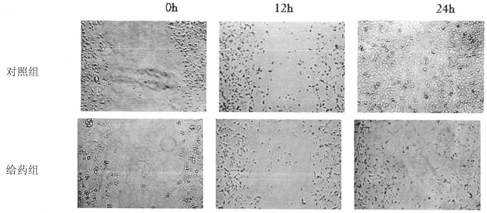 Preparation and application of low-toxicity effective fraction for suppressing angiogenesis in cowherb seed