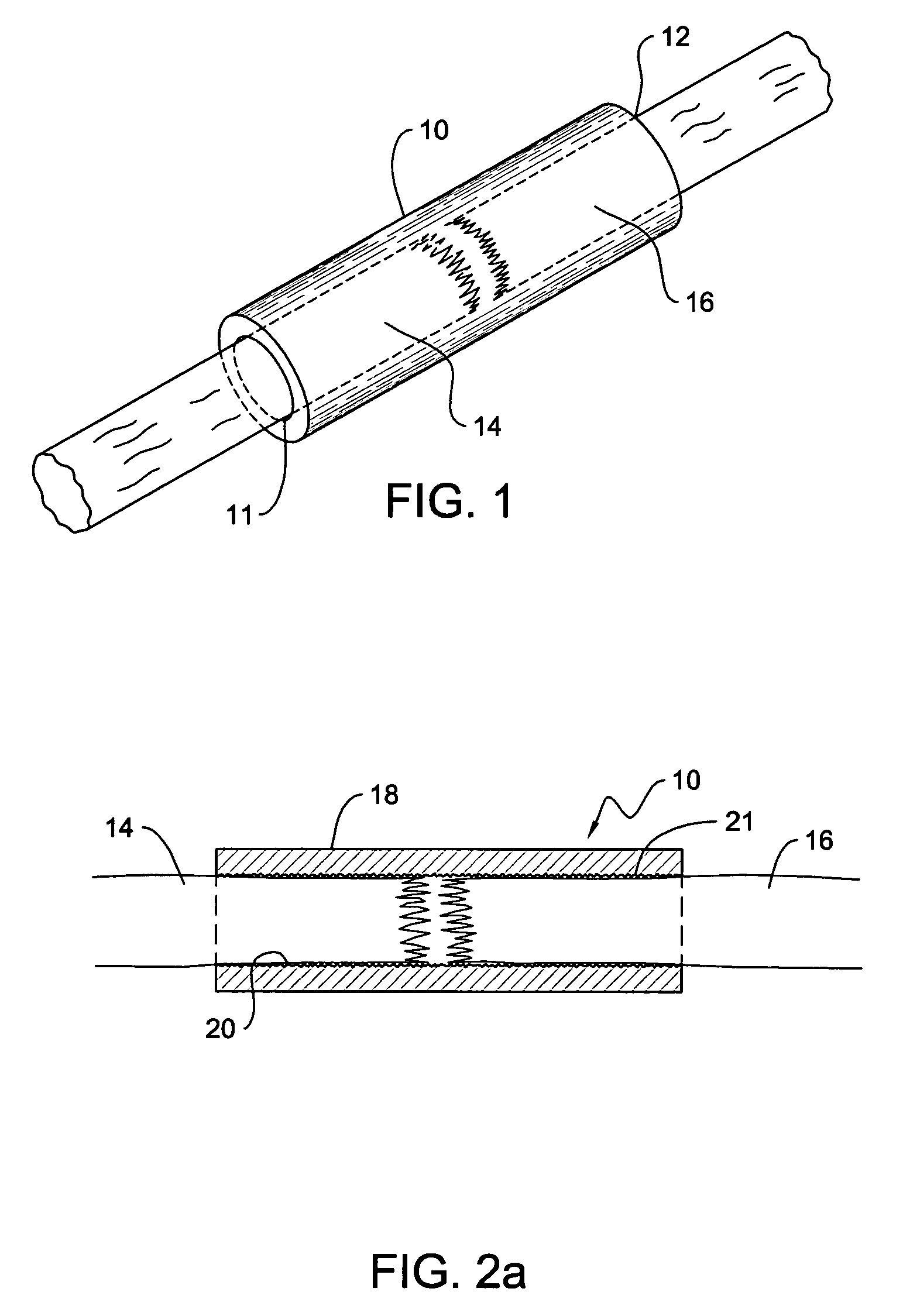 Sintered titanium tube for the management of spinal cord injury