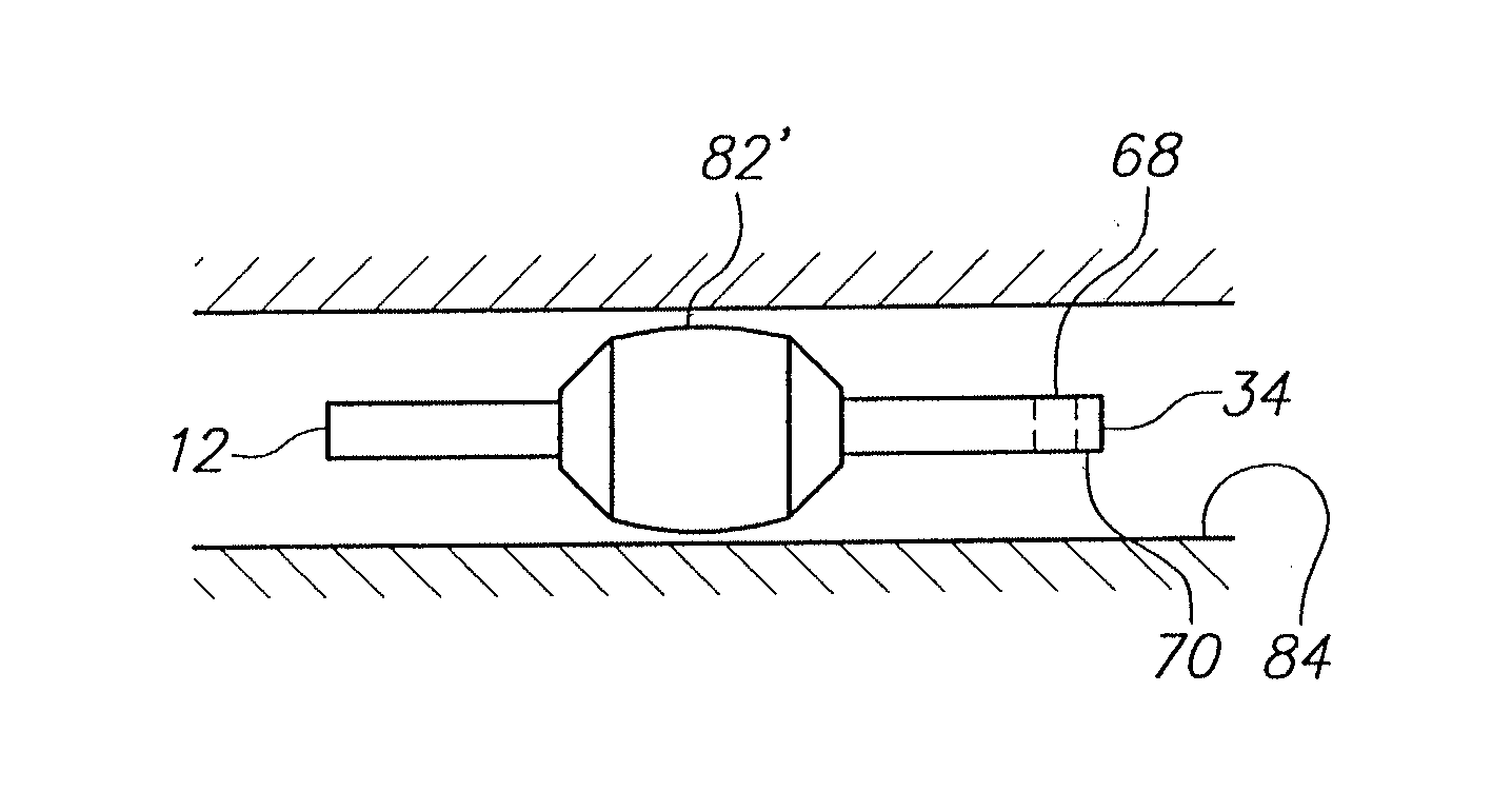 Infusion Catheter Tip for Biologics with Reinforced External Balloon Valve