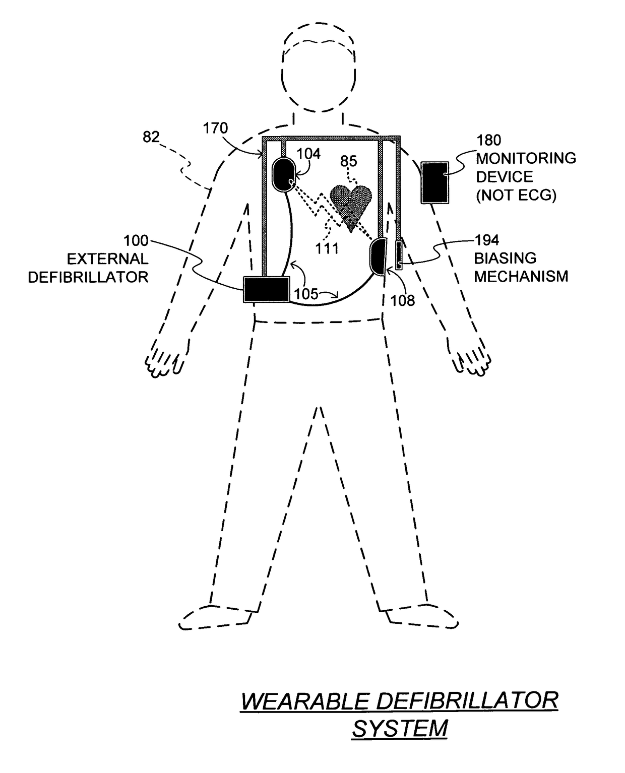 Wearable defibrillator with no long-term ECG monitoring