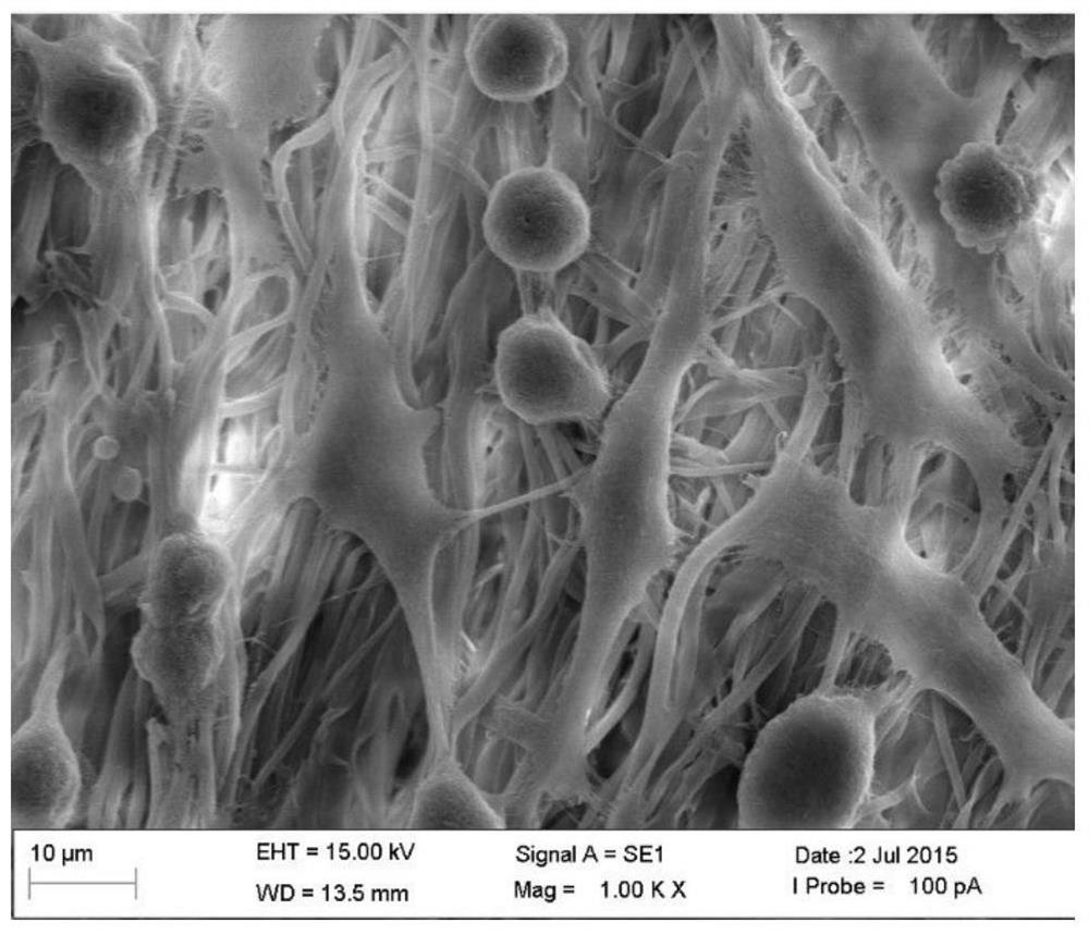 A kind of artificial nerve support and its preparation method and application