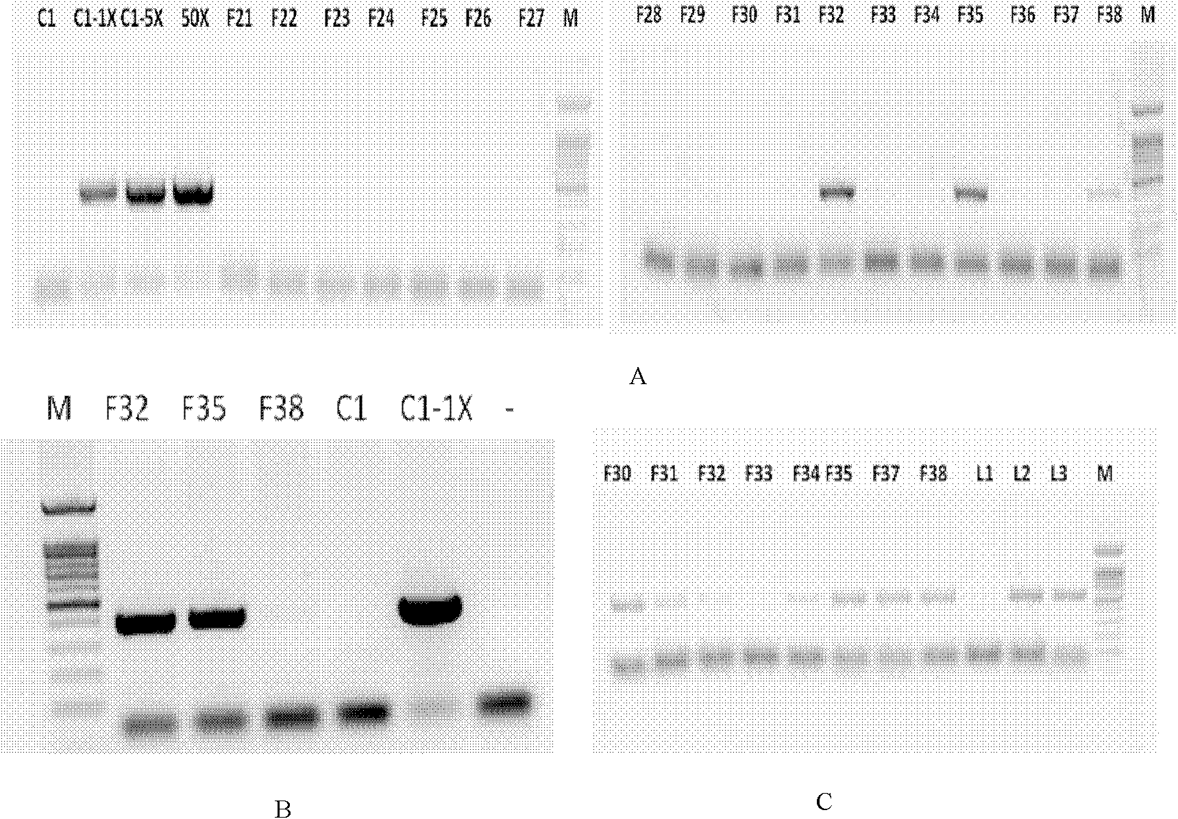 Method for constructing anti-mammitis transgenic mouse model and special vector for method