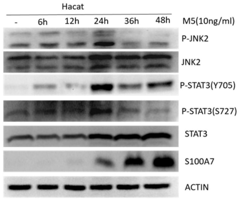 Use of methyl berberine as a jnk2 kinase inhibitor and in the treatment of psoriasis