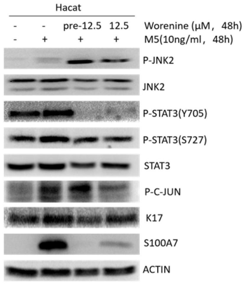 Use of methyl berberine as a jnk2 kinase inhibitor and in the treatment of psoriasis