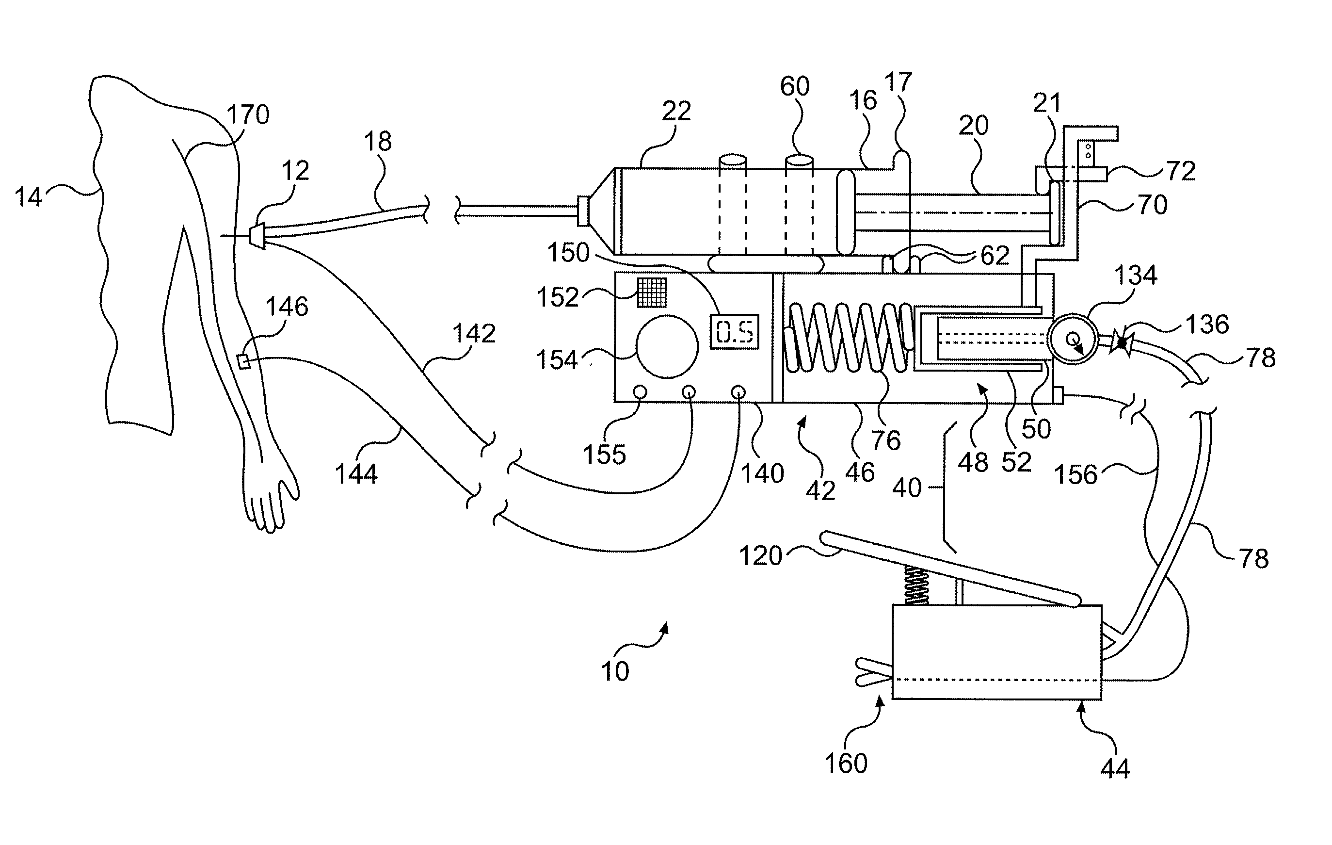 Apparatus for locating and anesthetizing nerve groups