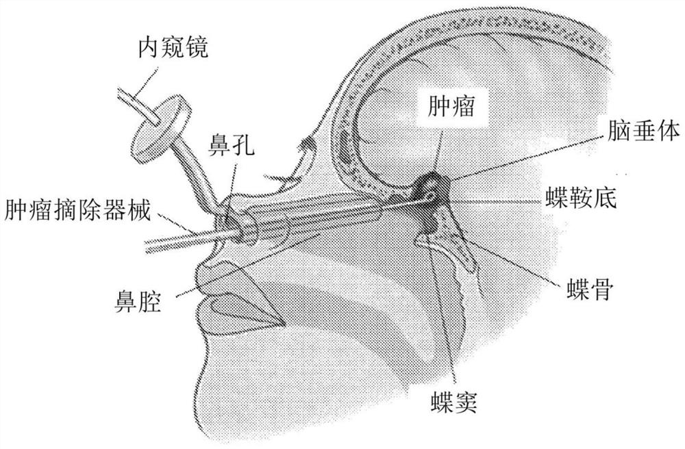 Evaluation model for endoscopic transnasal surgery, simulated dura mater unit, and evaluation method for operative procedure