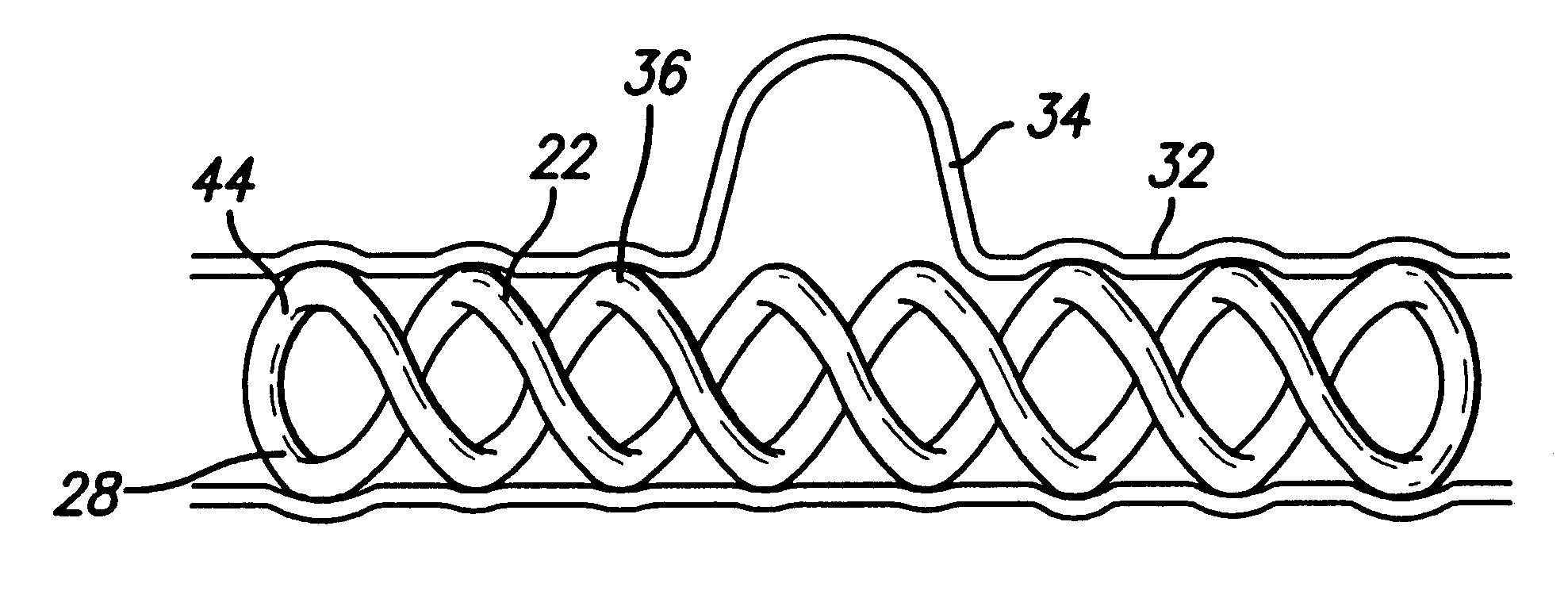 Insitu formable and self-forming intravascular flow modifier (IFM) and IFM assembly for deployment of same