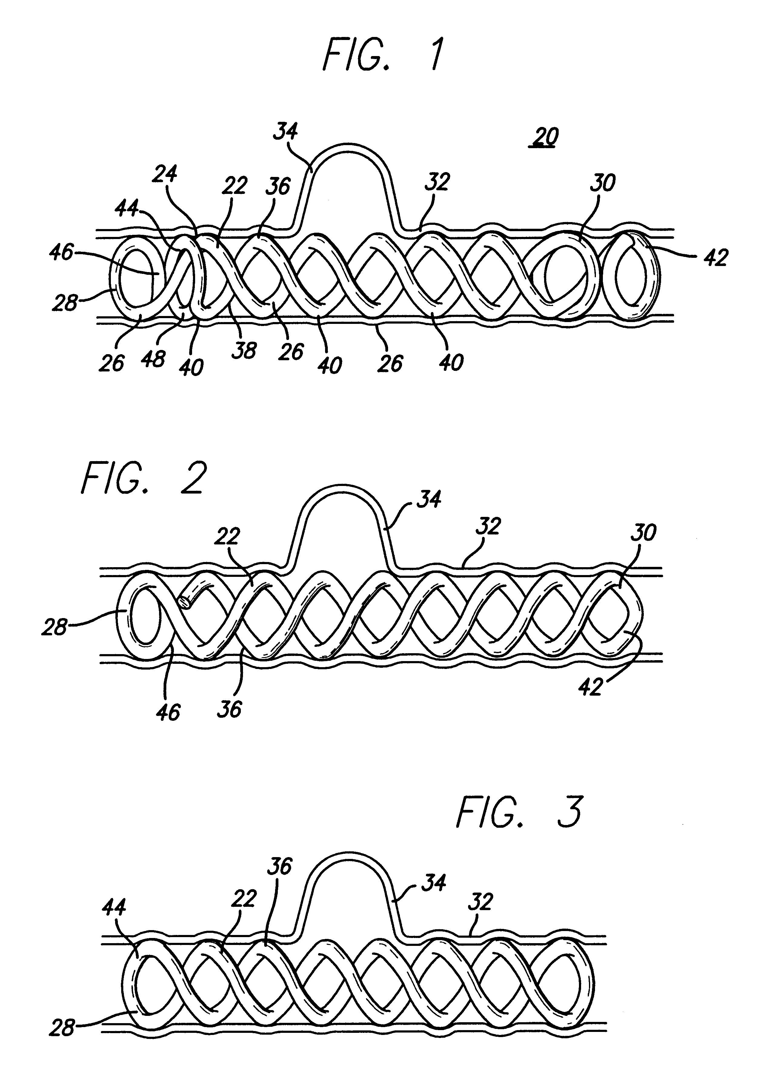 Insitu formable and self-forming intravascular flow modifier (IFM) and IFM assembly for deployment of same