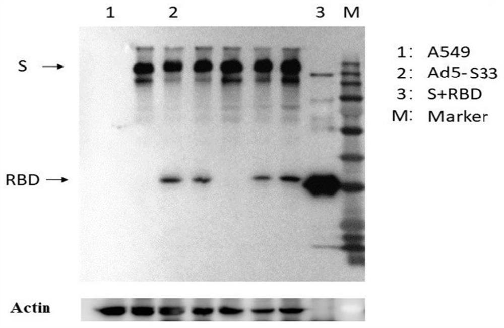 Adenovirus vector vaccine for preventing SARS-CoV-2 original strain and Beta strain