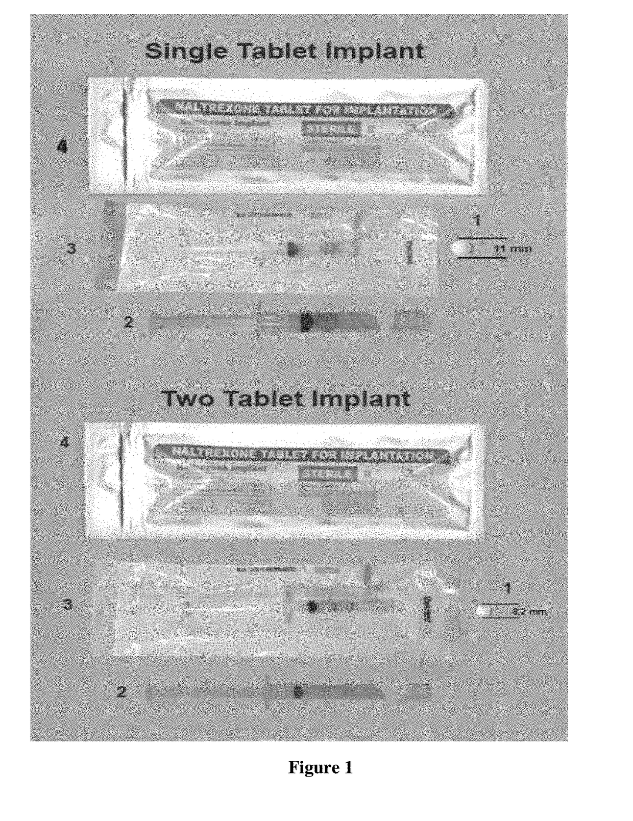 Implantable Naltrexone Tablets
