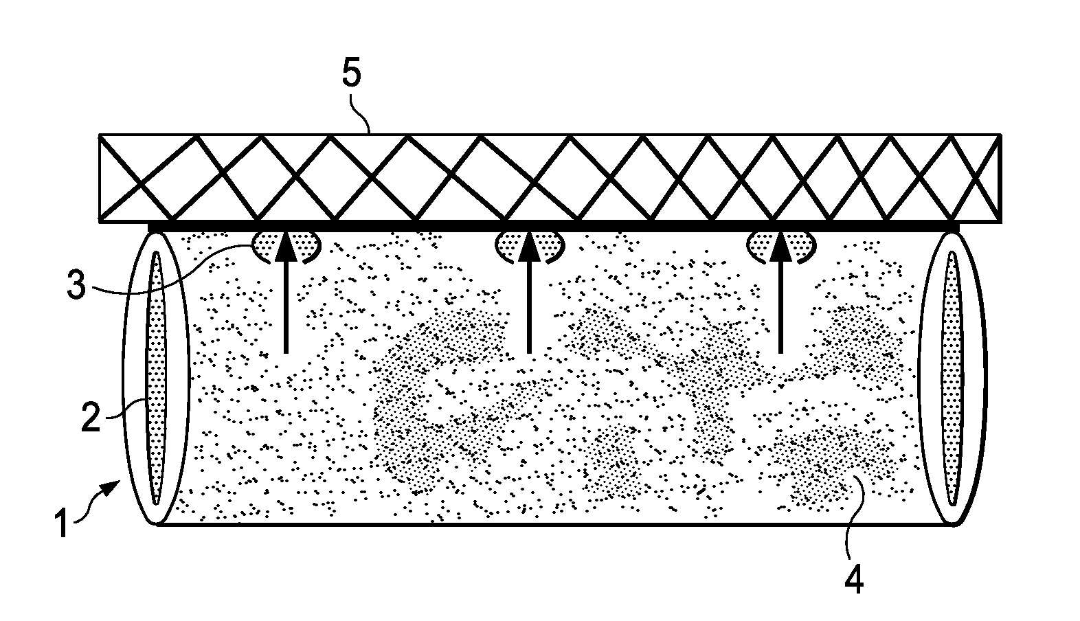 Therapeutic Methods Using Controlled Delivery Devices Having Zero Order Kinetics