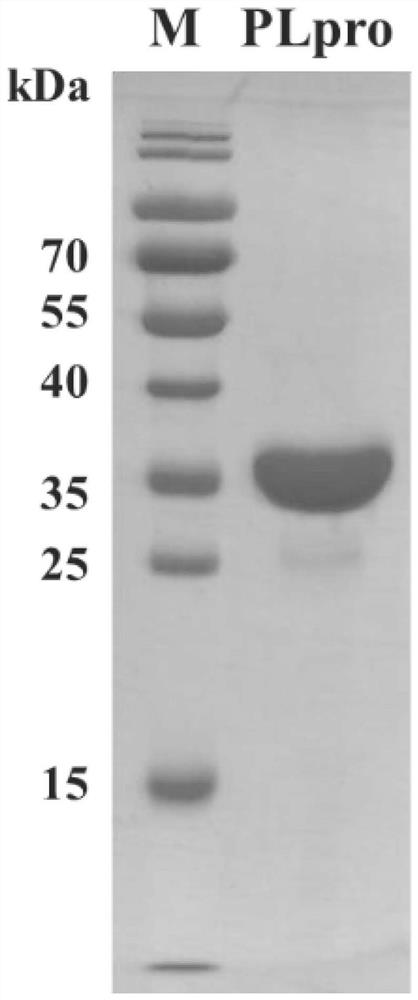 Application of PLpro protein inhibitor in medicine for treating or preventing novel coronavirus infection