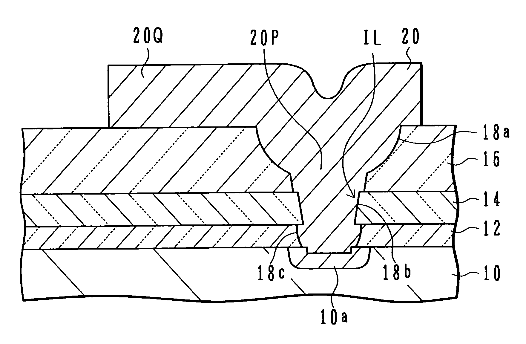 Micro structure with interlock configuration