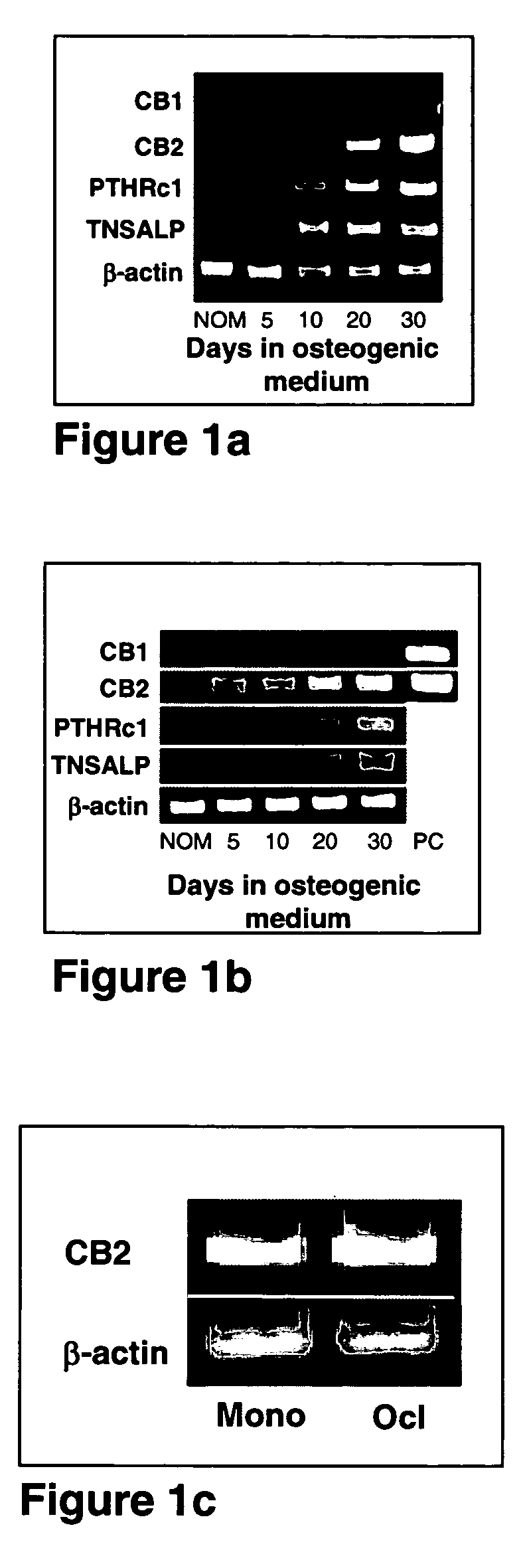 Methods, kits and pharmaceutical compositions for diagnosing, delaying onset of, preventing and/or treating osteoporosis