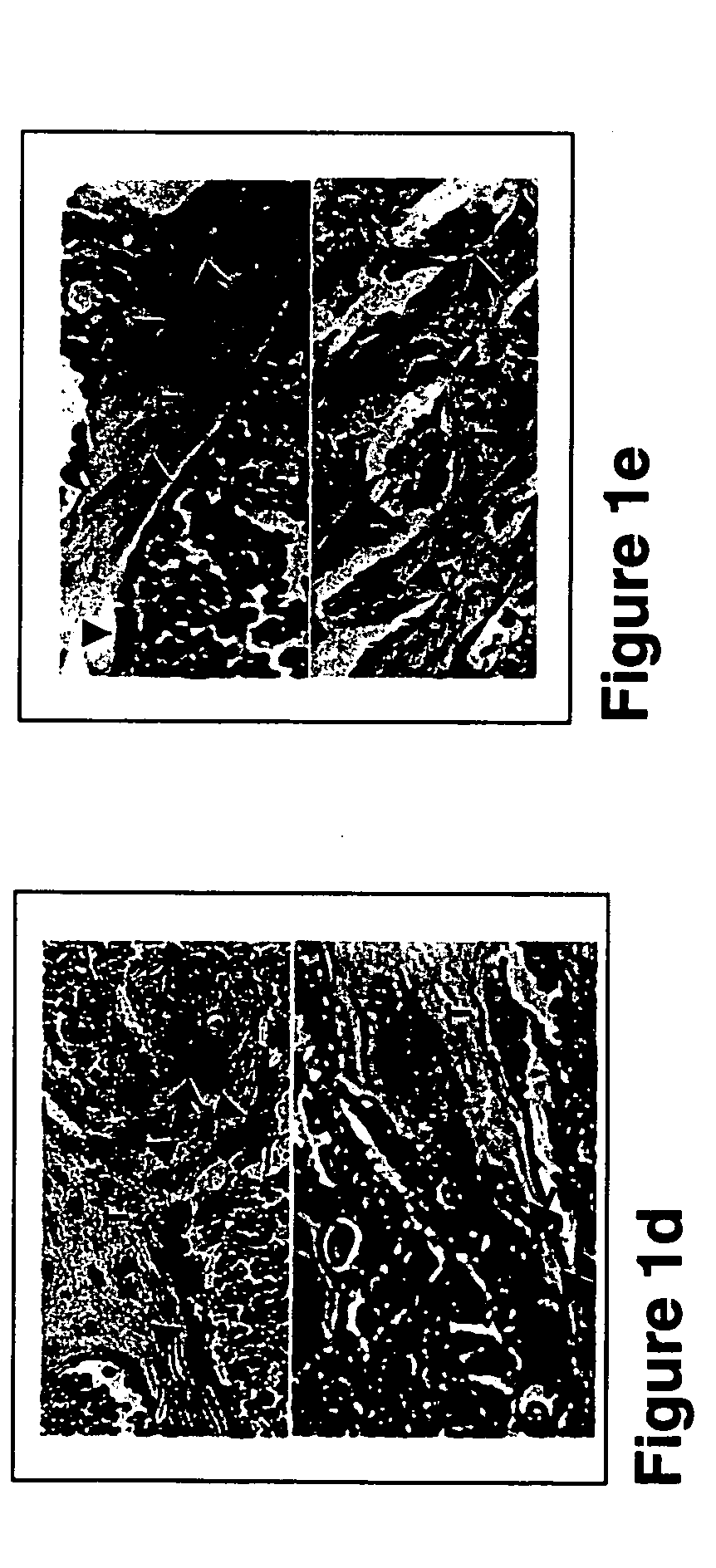 Methods, kits and pharmaceutical compositions for diagnosing, delaying onset of, preventing and/or treating osteoporosis