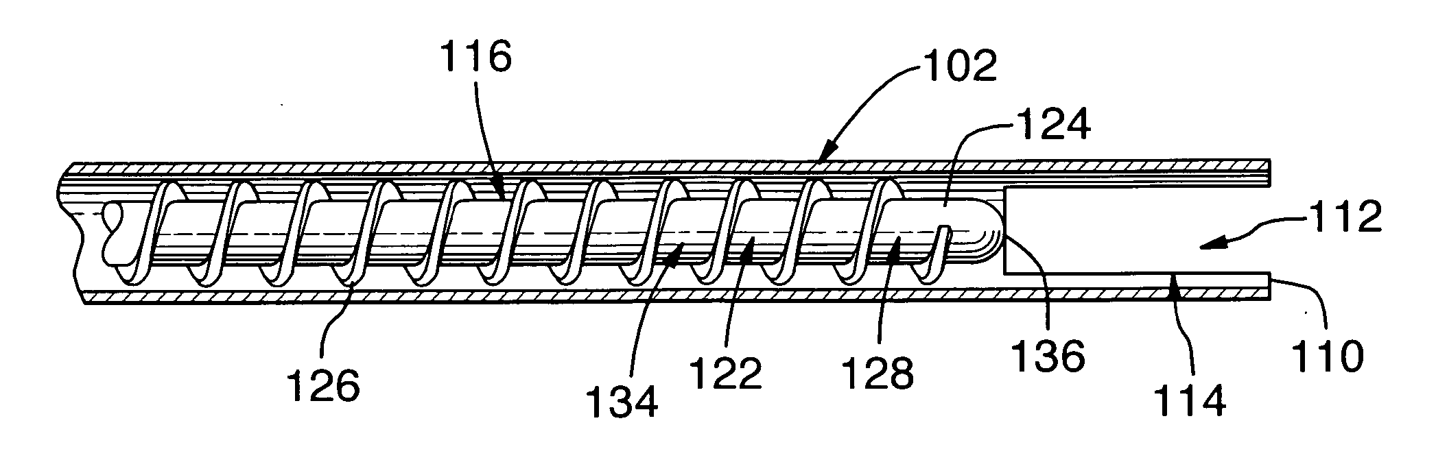 Method for removing material from a patient's body